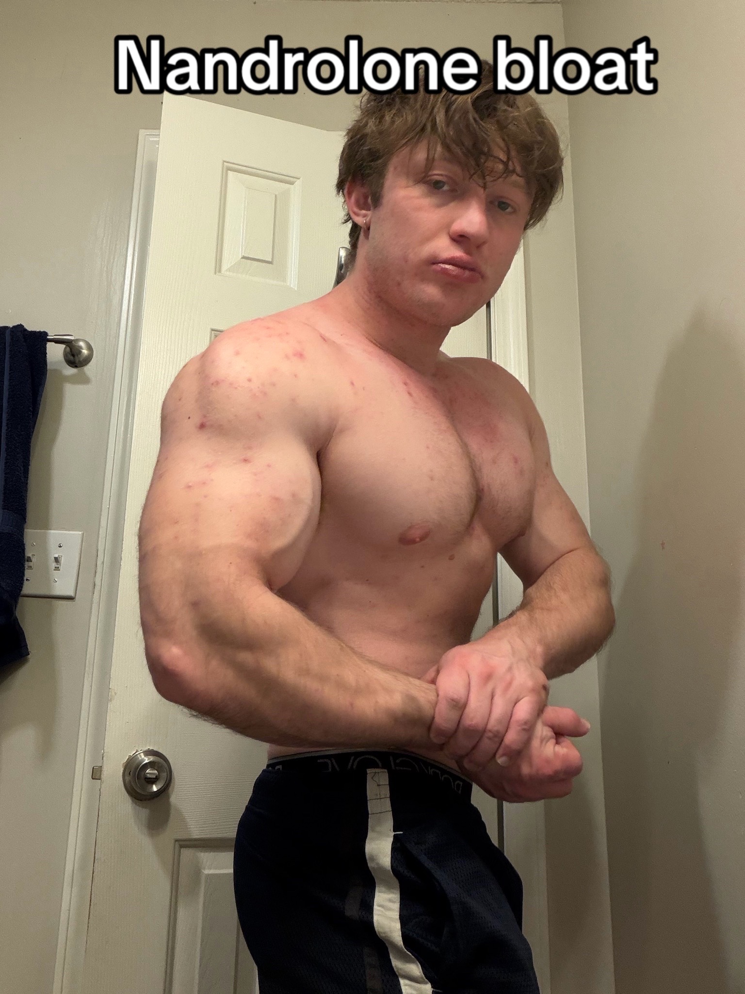 @NattySux