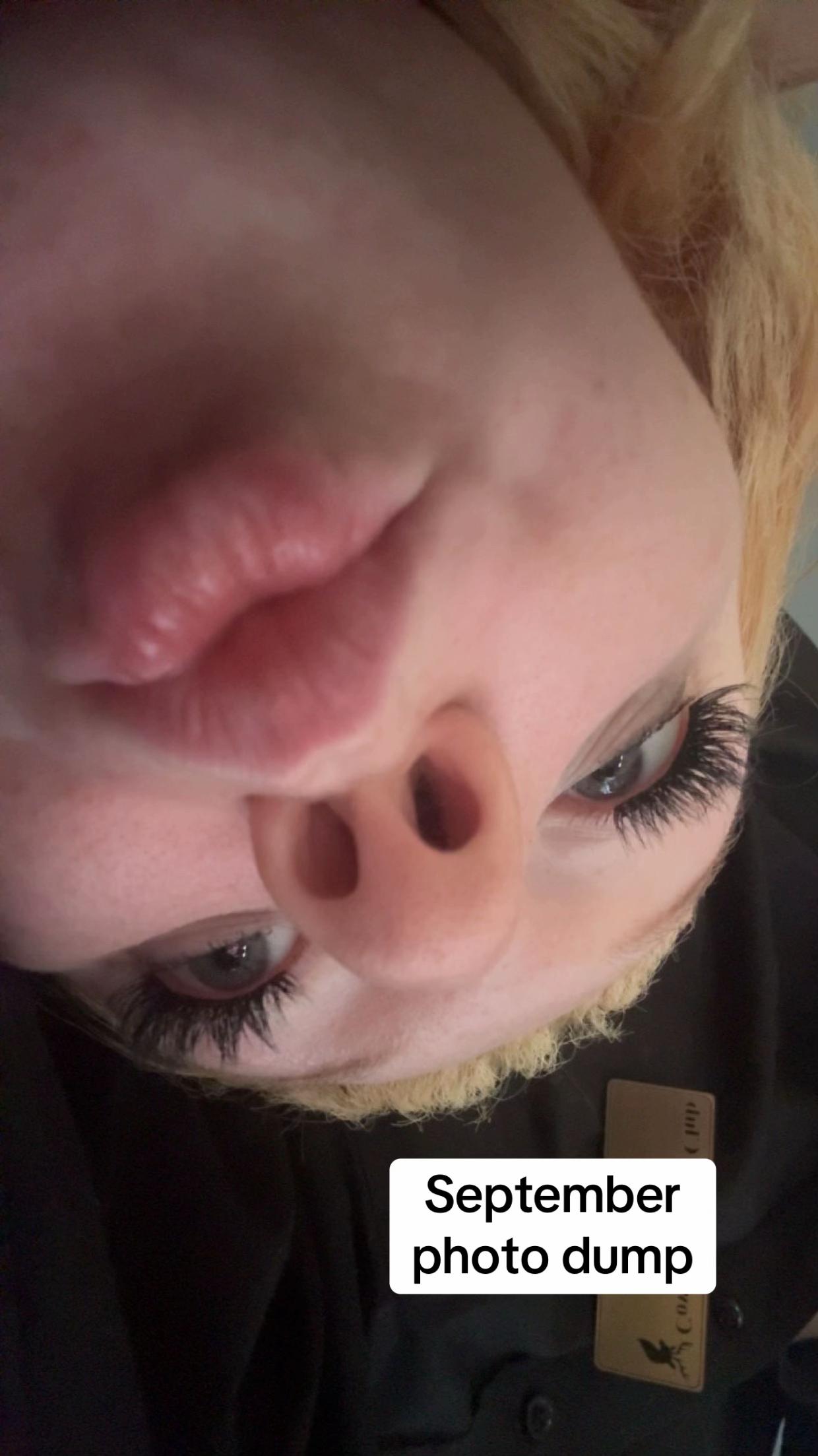 @Emily normal