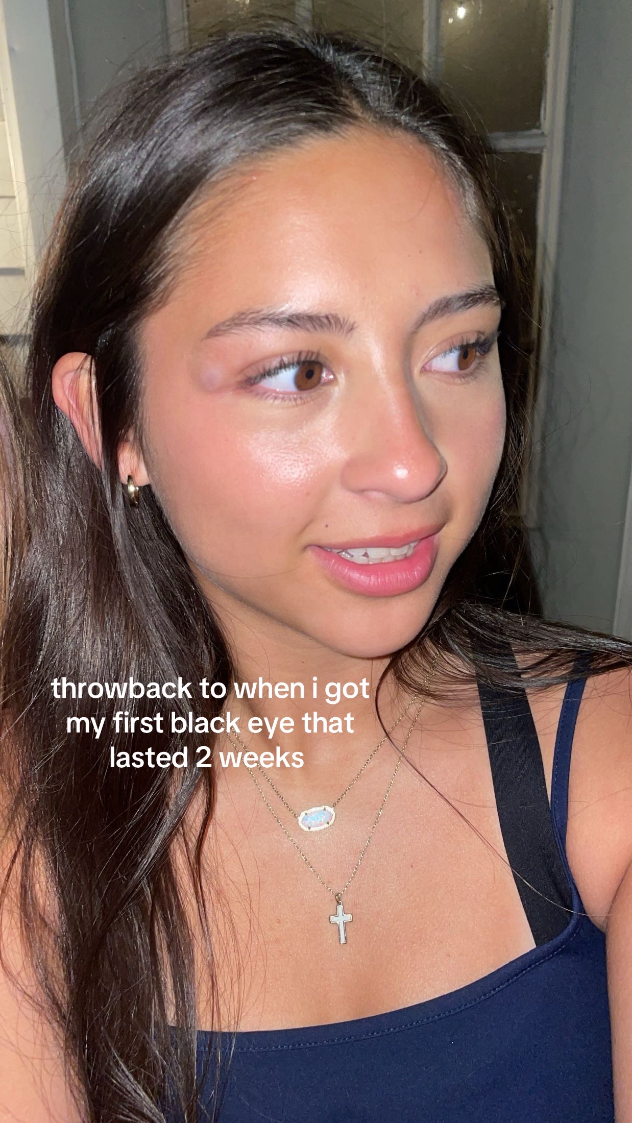 @lola