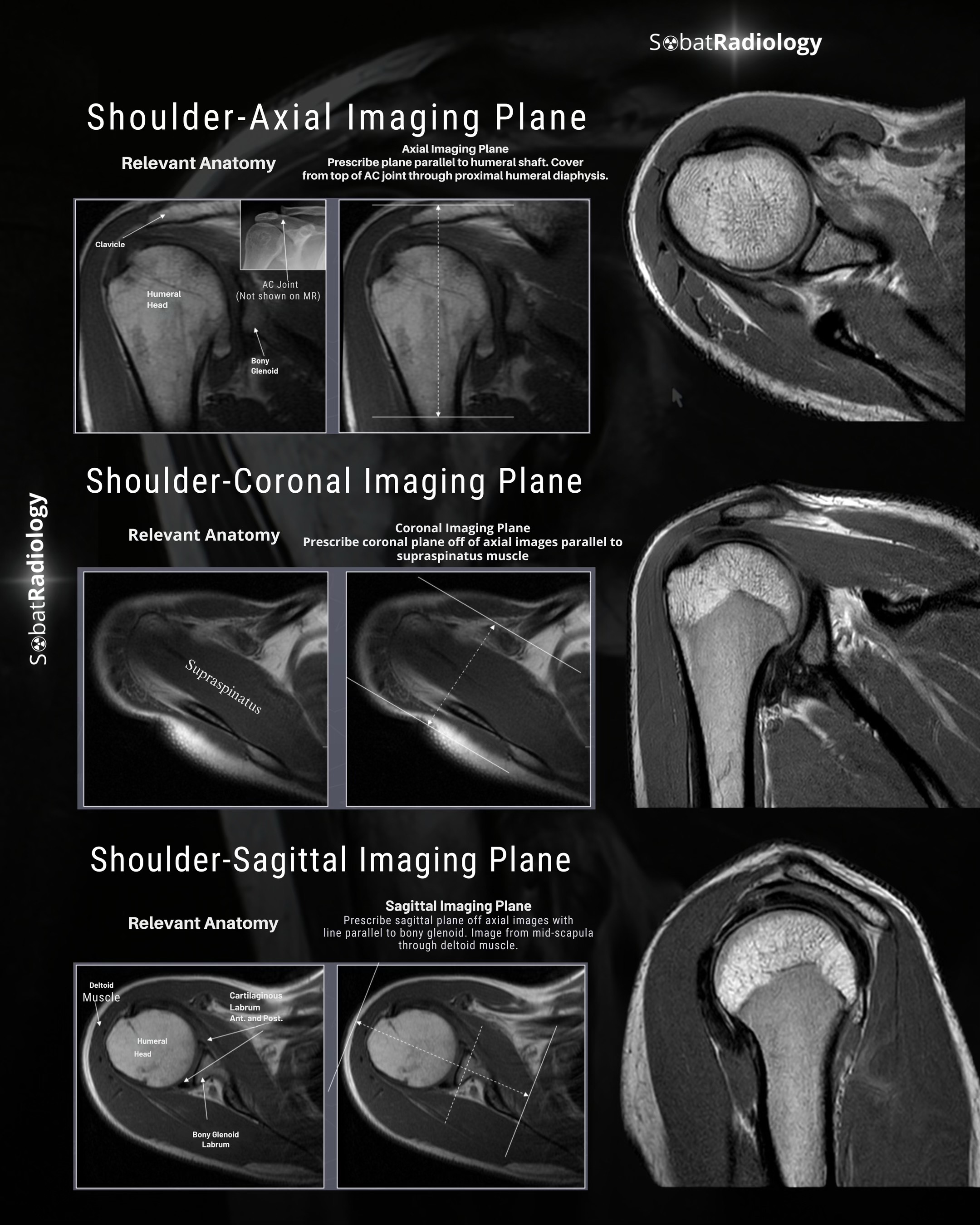 @Sobat Radiology