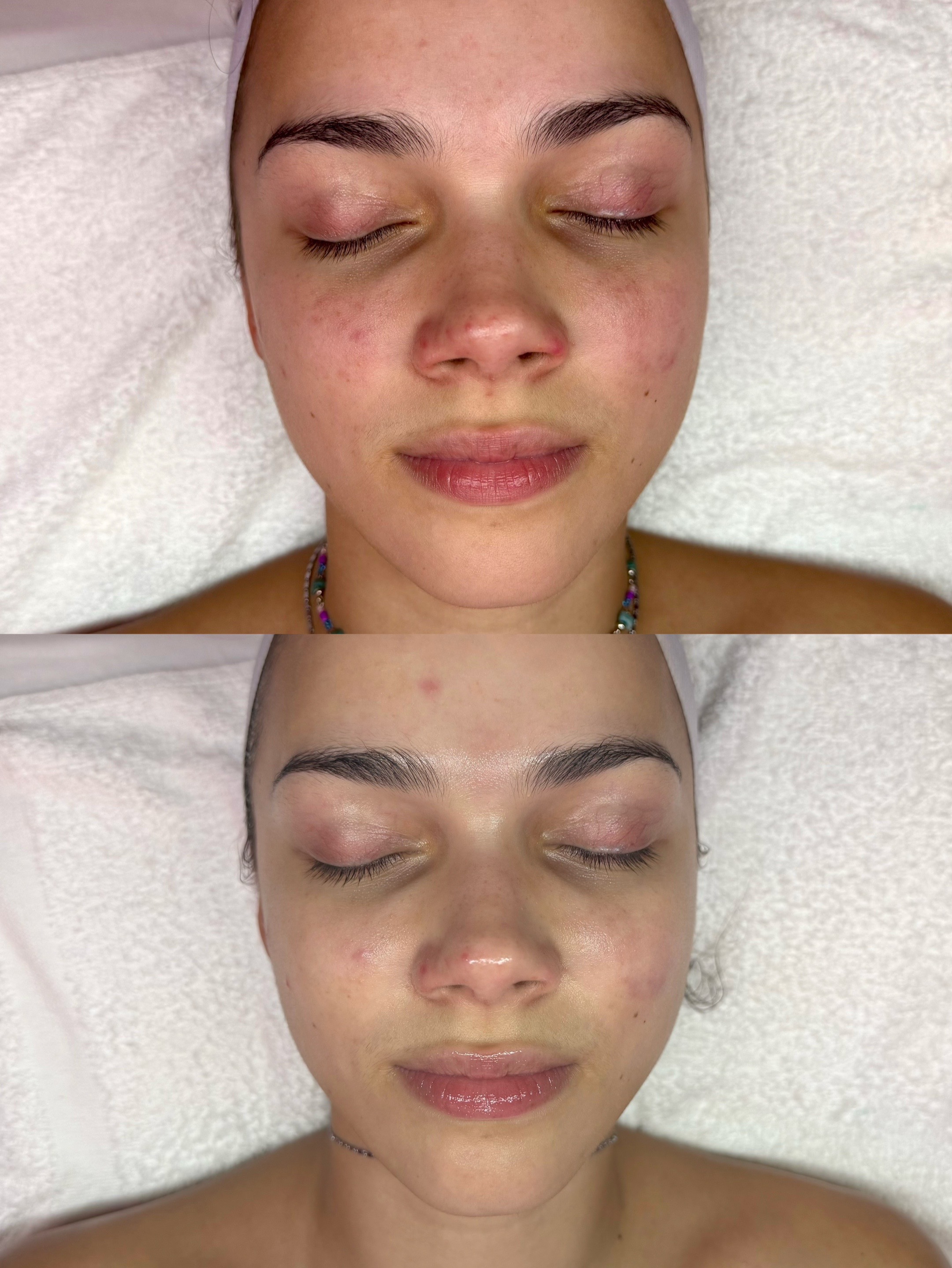 @HappySkinBySara