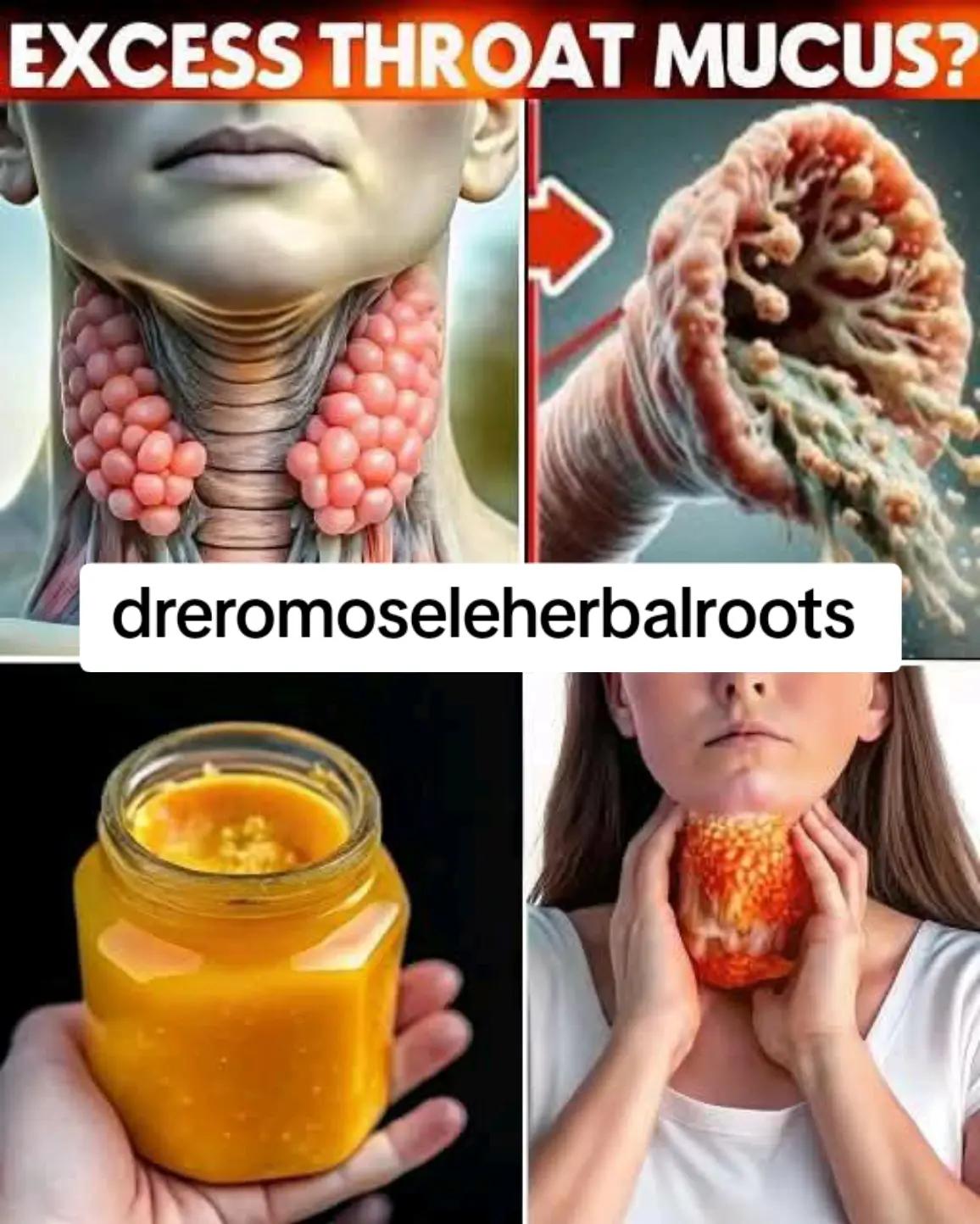 @DR EROMOSELE HERBALROOTS