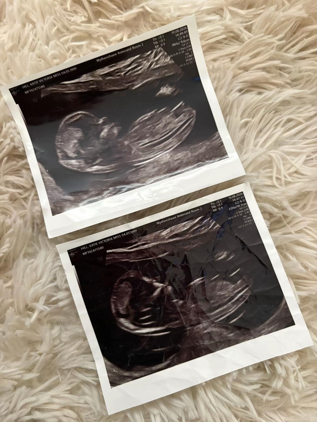 @Katie|Motherhood&Life🧿