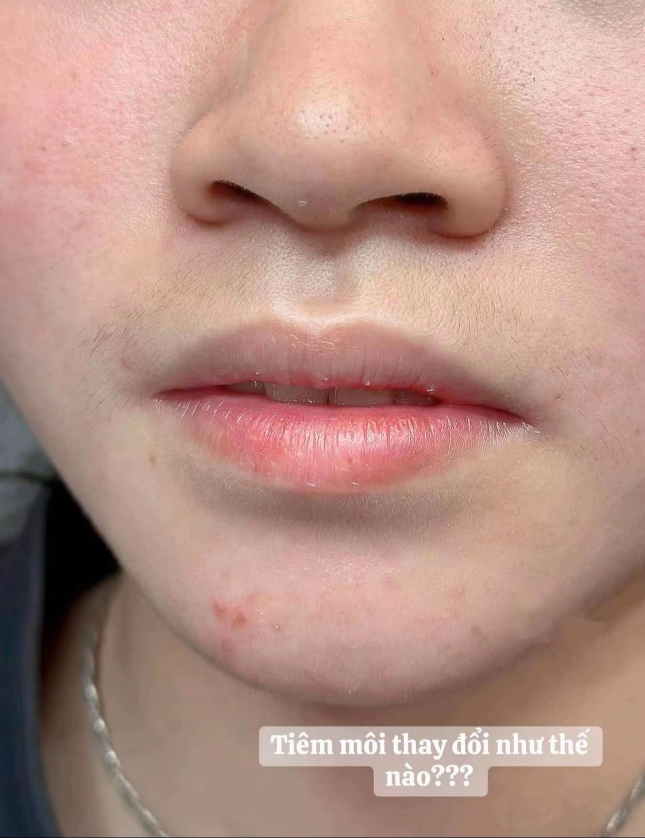 @Trần L&agrave;i 98