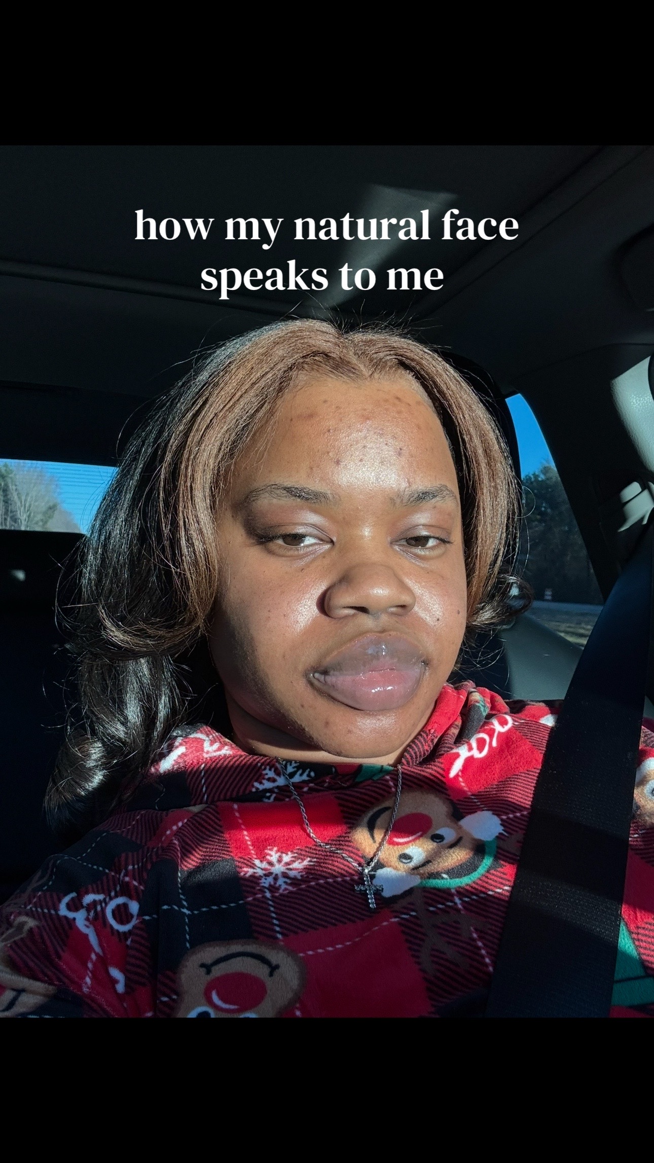 @AB