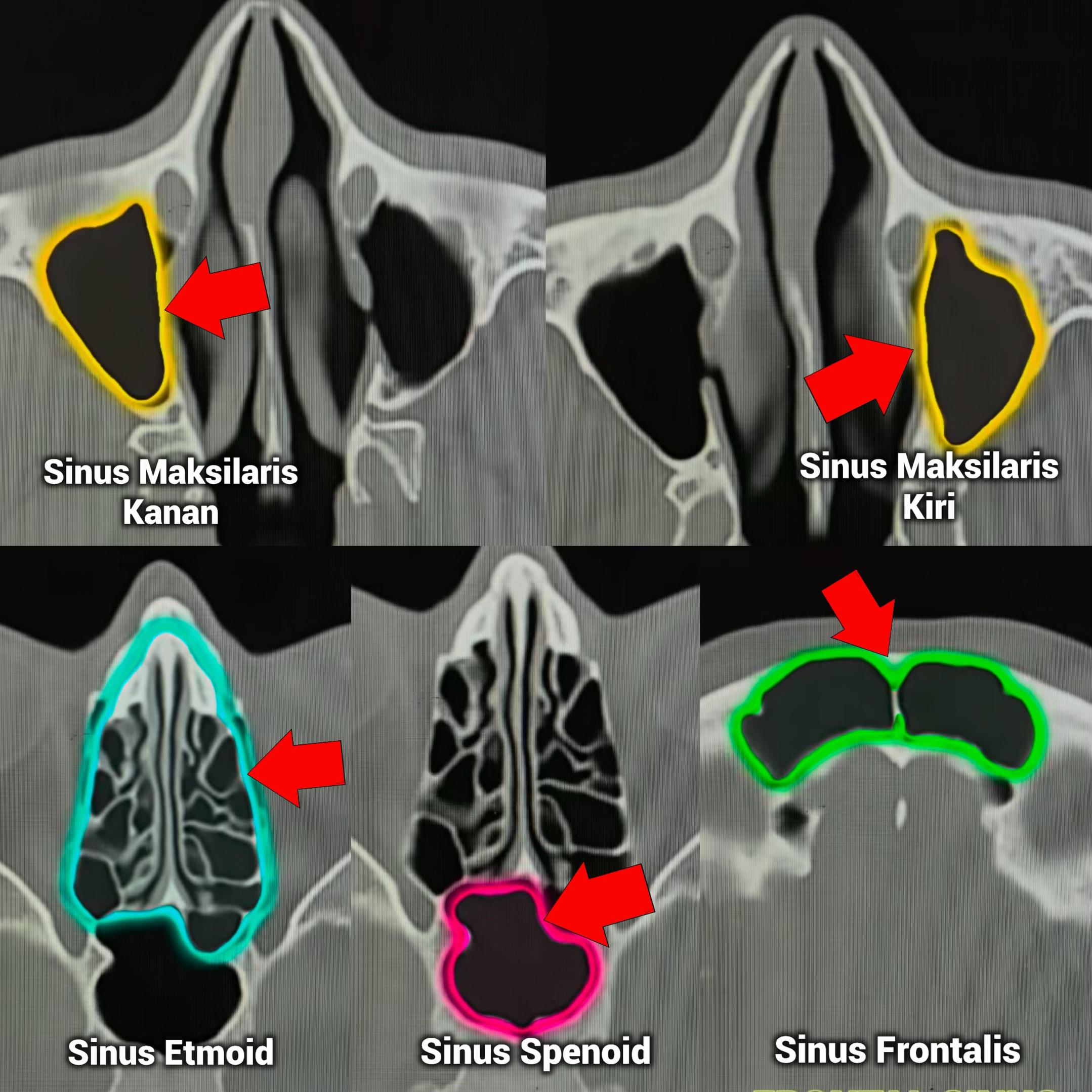 @Sobat Radiology