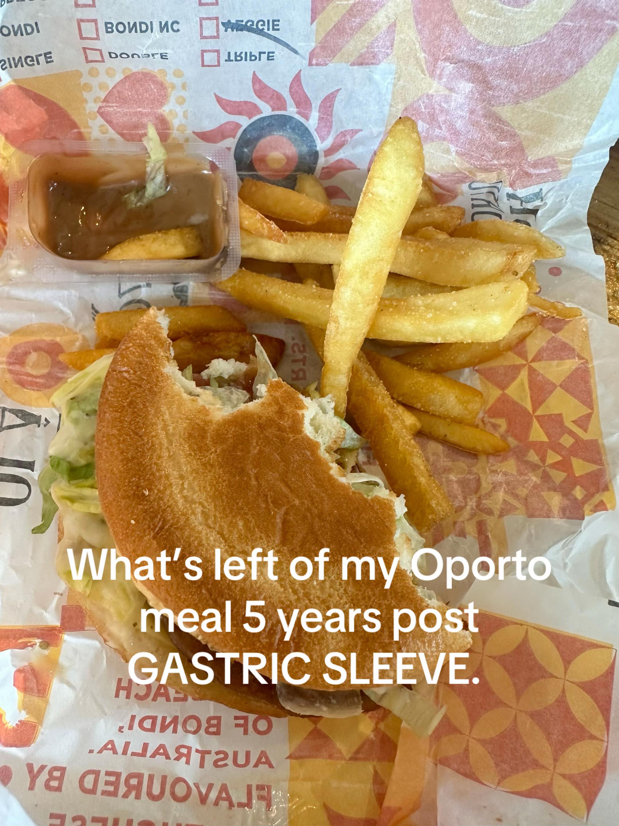 @Post-gastric-sleeve ๐