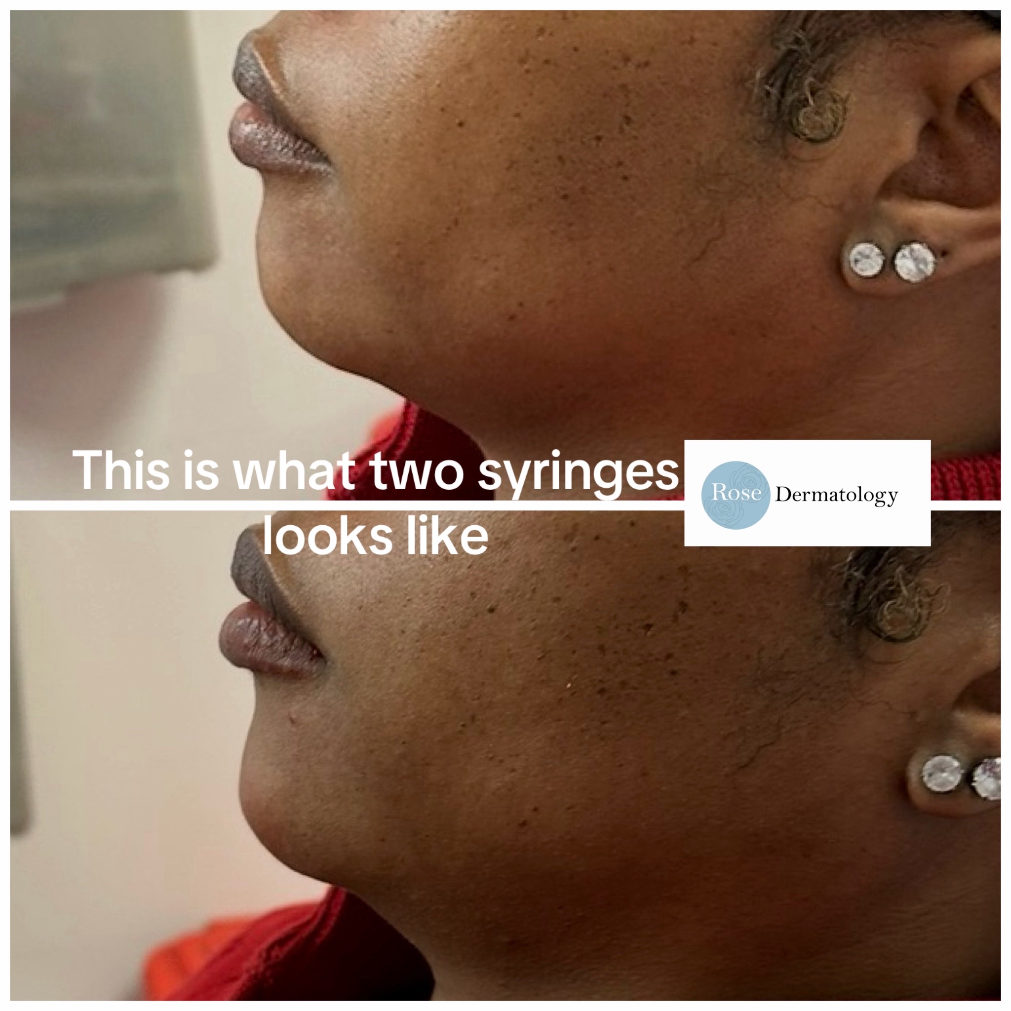 @Rosedermnyc