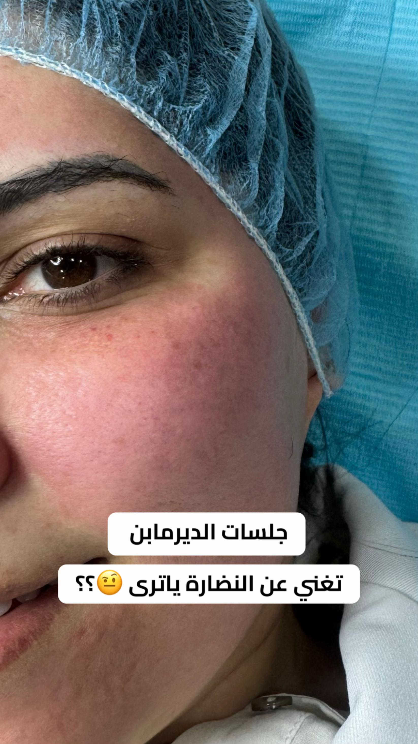 @أخصائية البشرة نورا