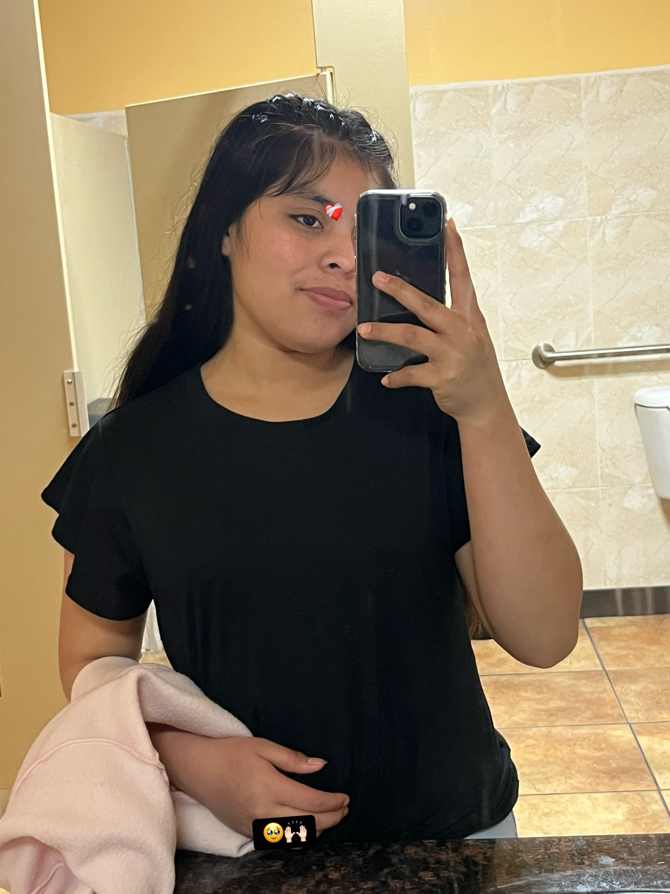 @Yohana ᵖ🪐❤️&zwj;🩹🥀