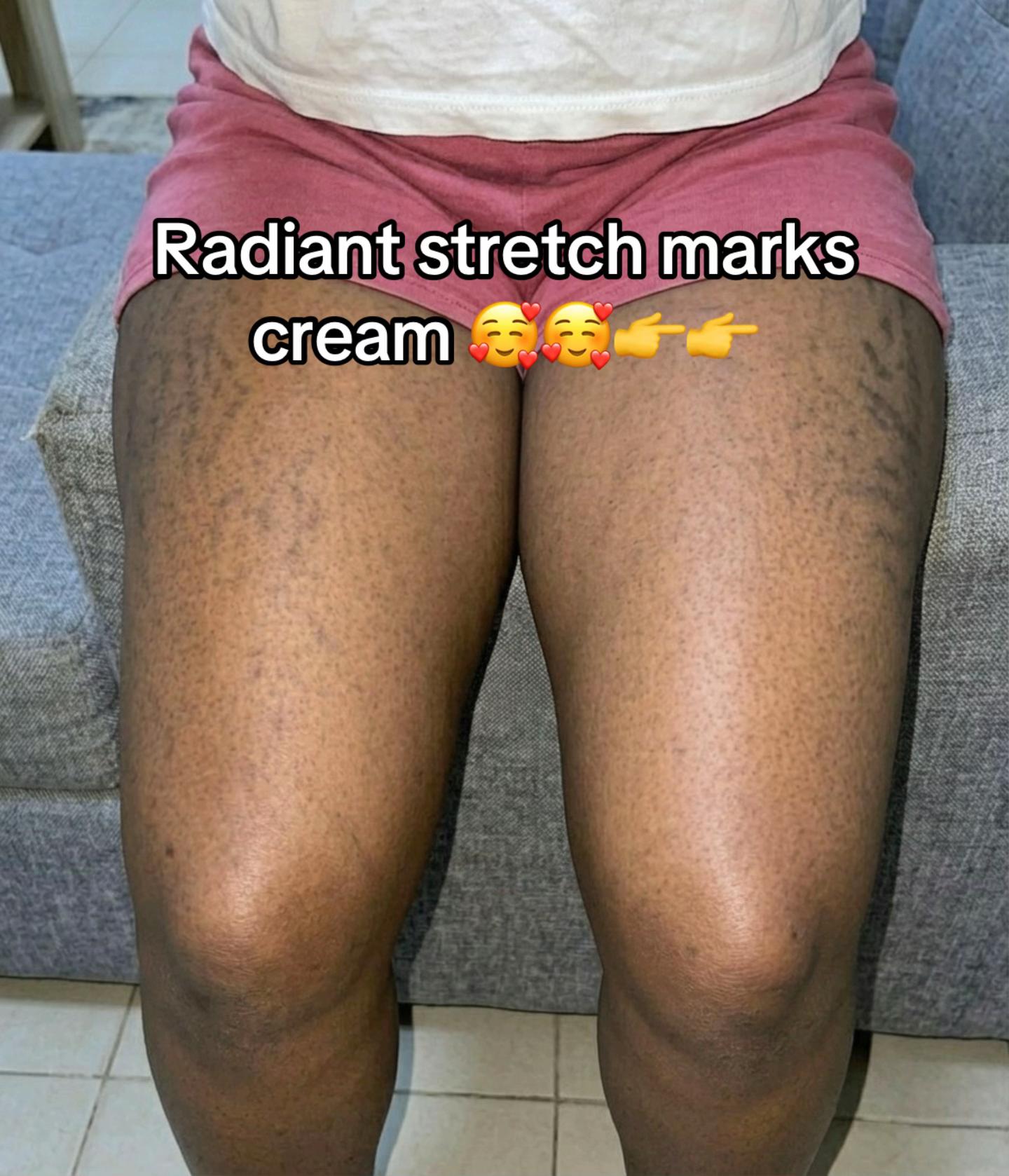 @Radiant skin