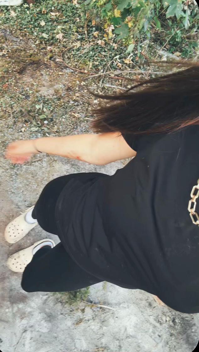 @⚜️𝐬𝐜𝐚𝐫⚜️