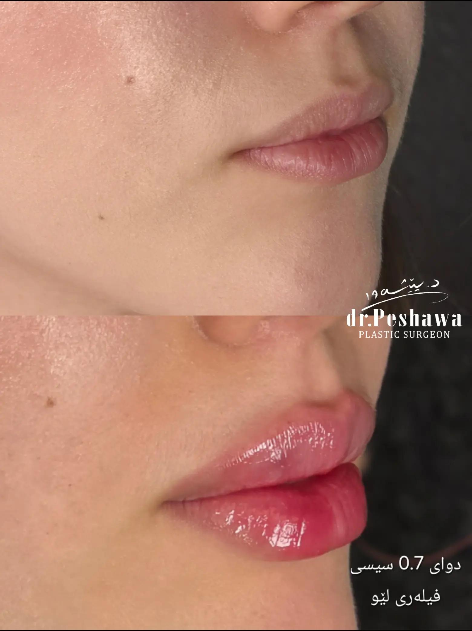 @Dr. Peshawa Plastic Surgeon