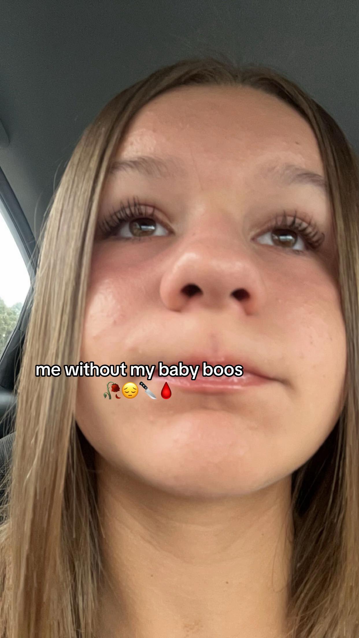 @🫰