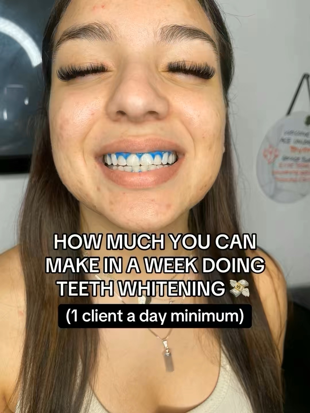 @Diandra | Teeth Whitening Tech