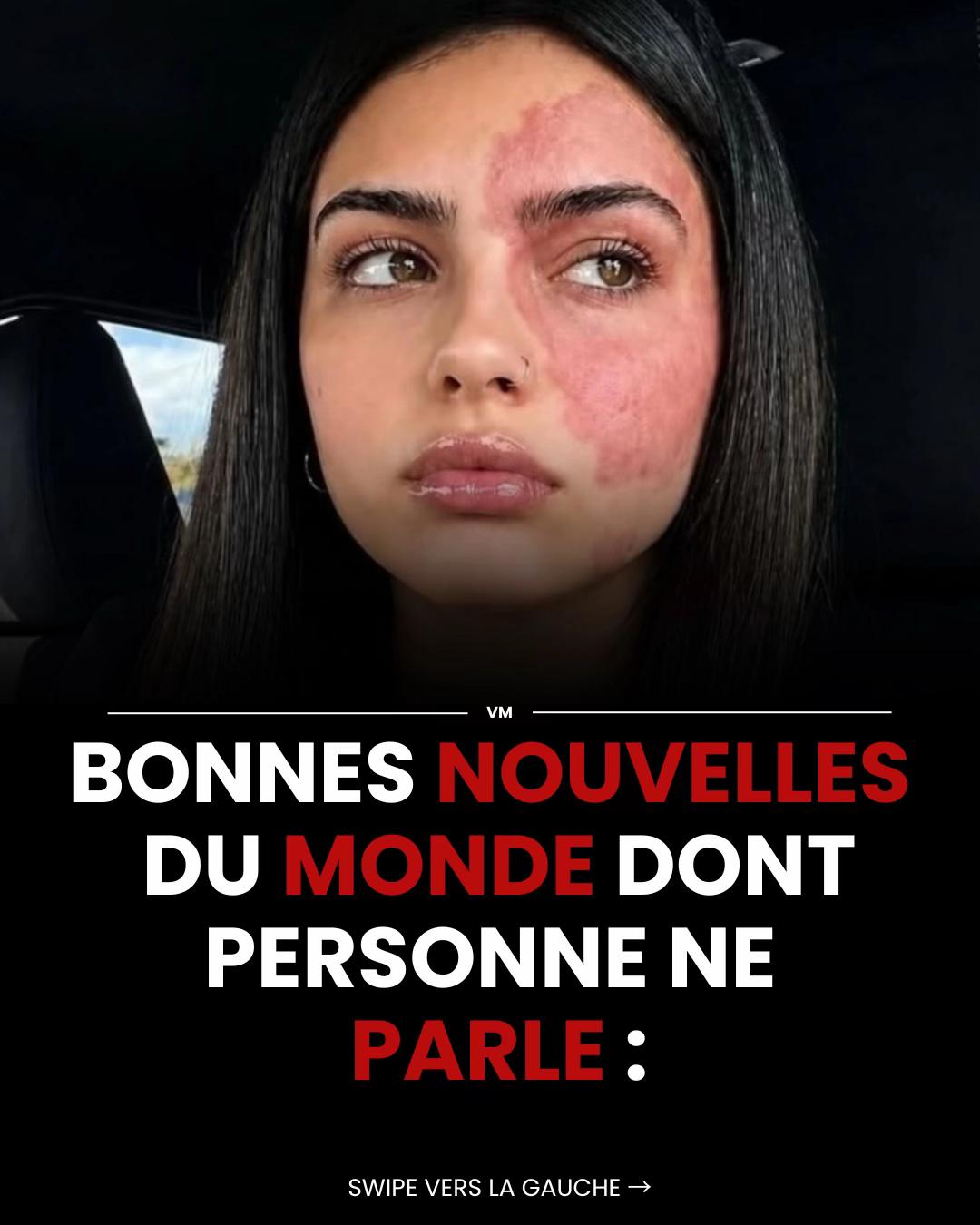 @Vision_succ&egrave;s