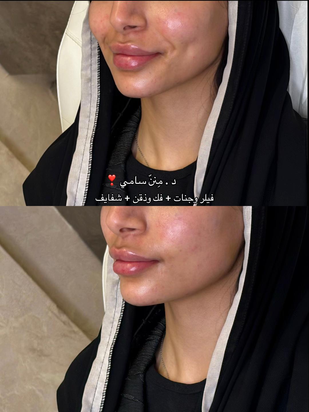@مركز مزدانه 1 ( فرع الصحافه )