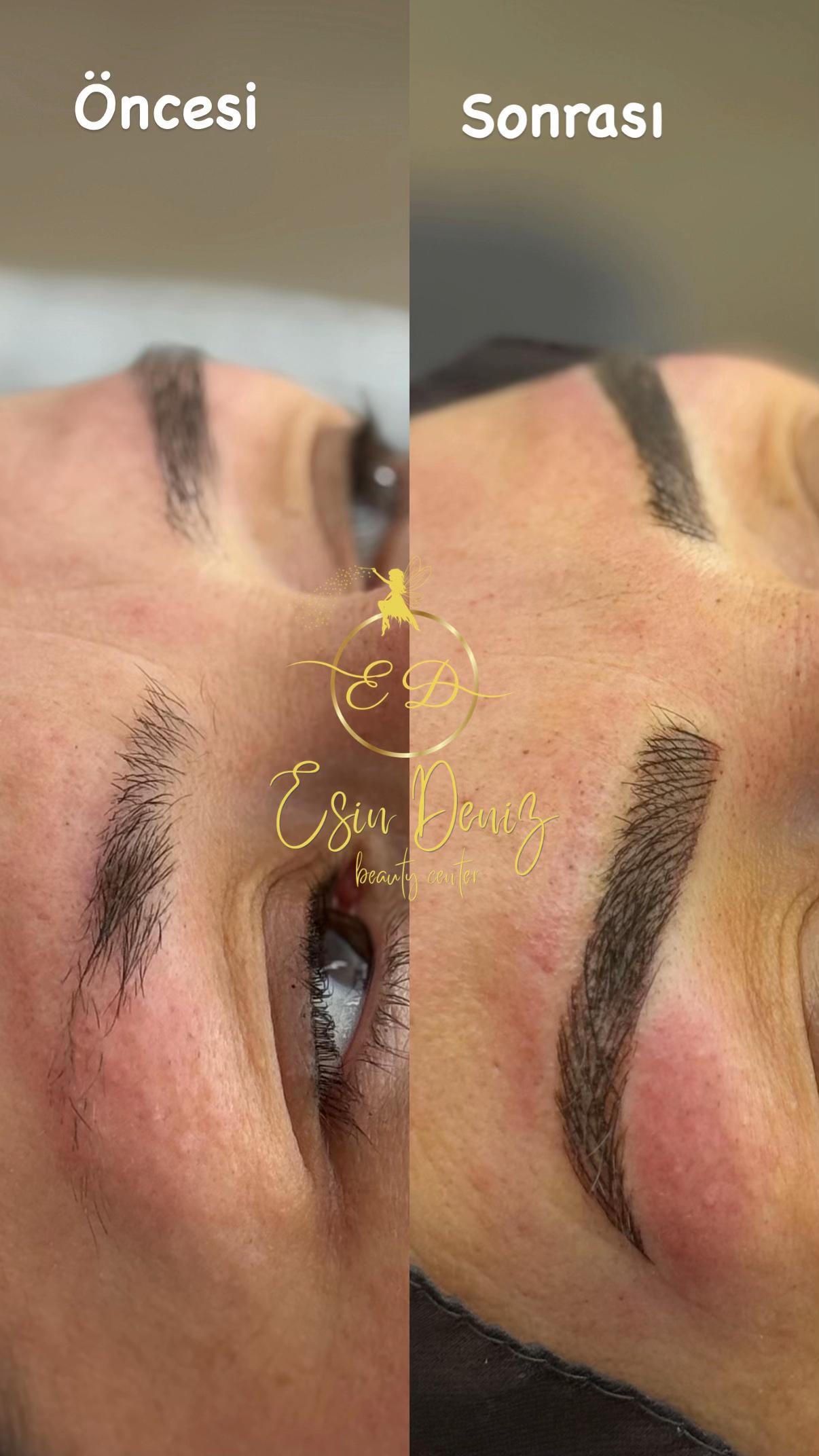 @Esin Deniz Beauty center
