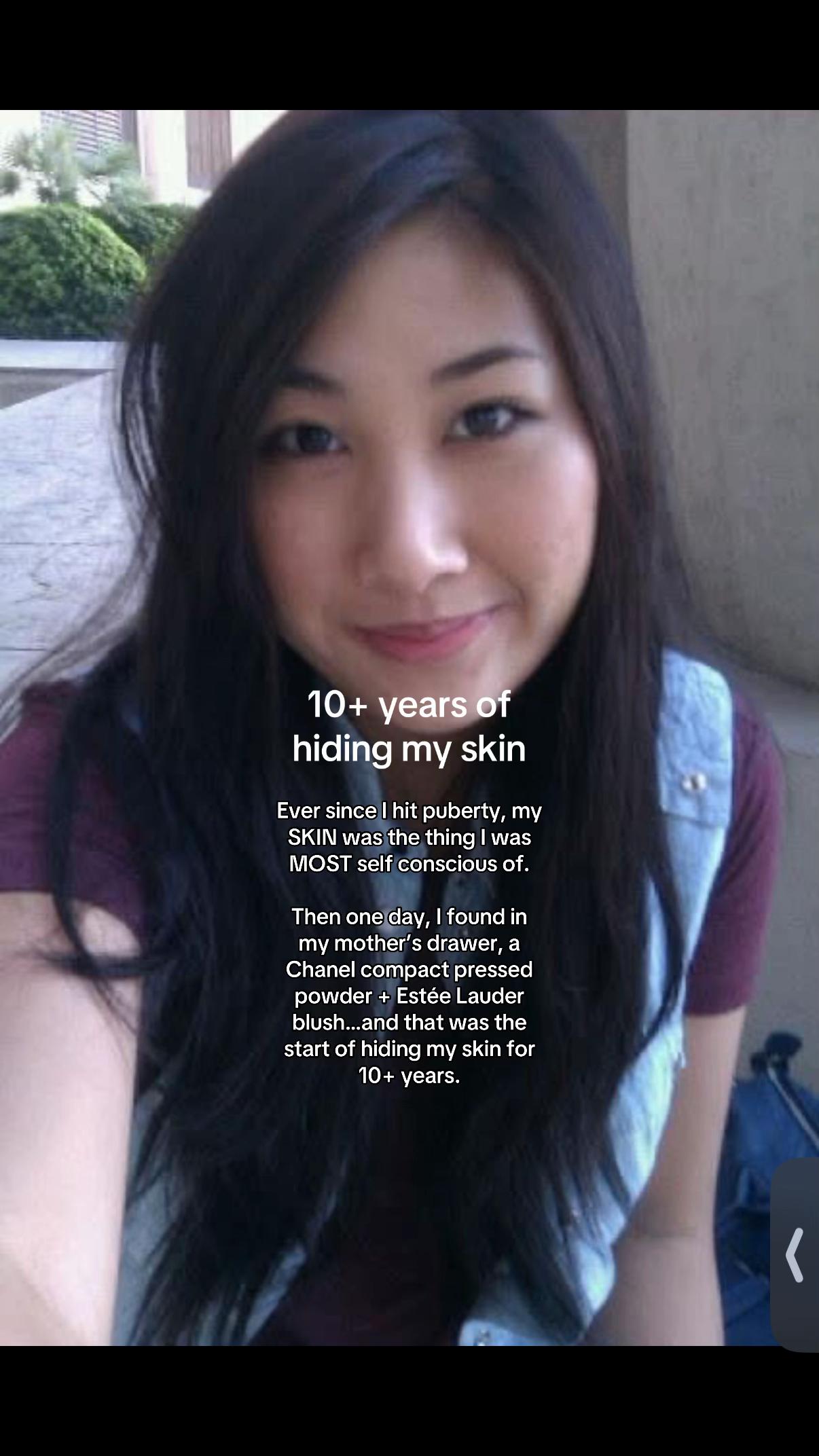 @Lisa | acne → clear skin