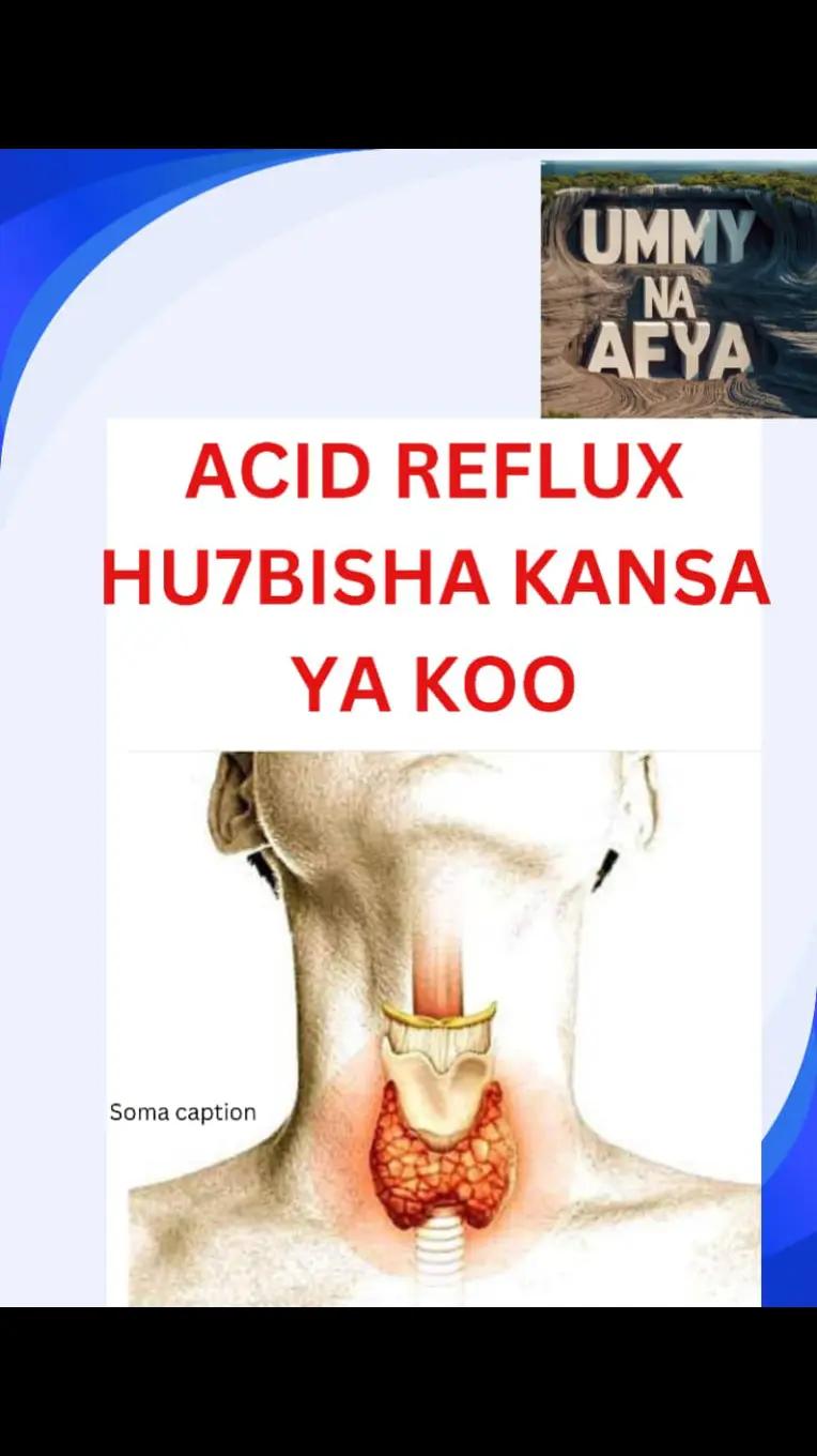 @Ummy Yusuph
