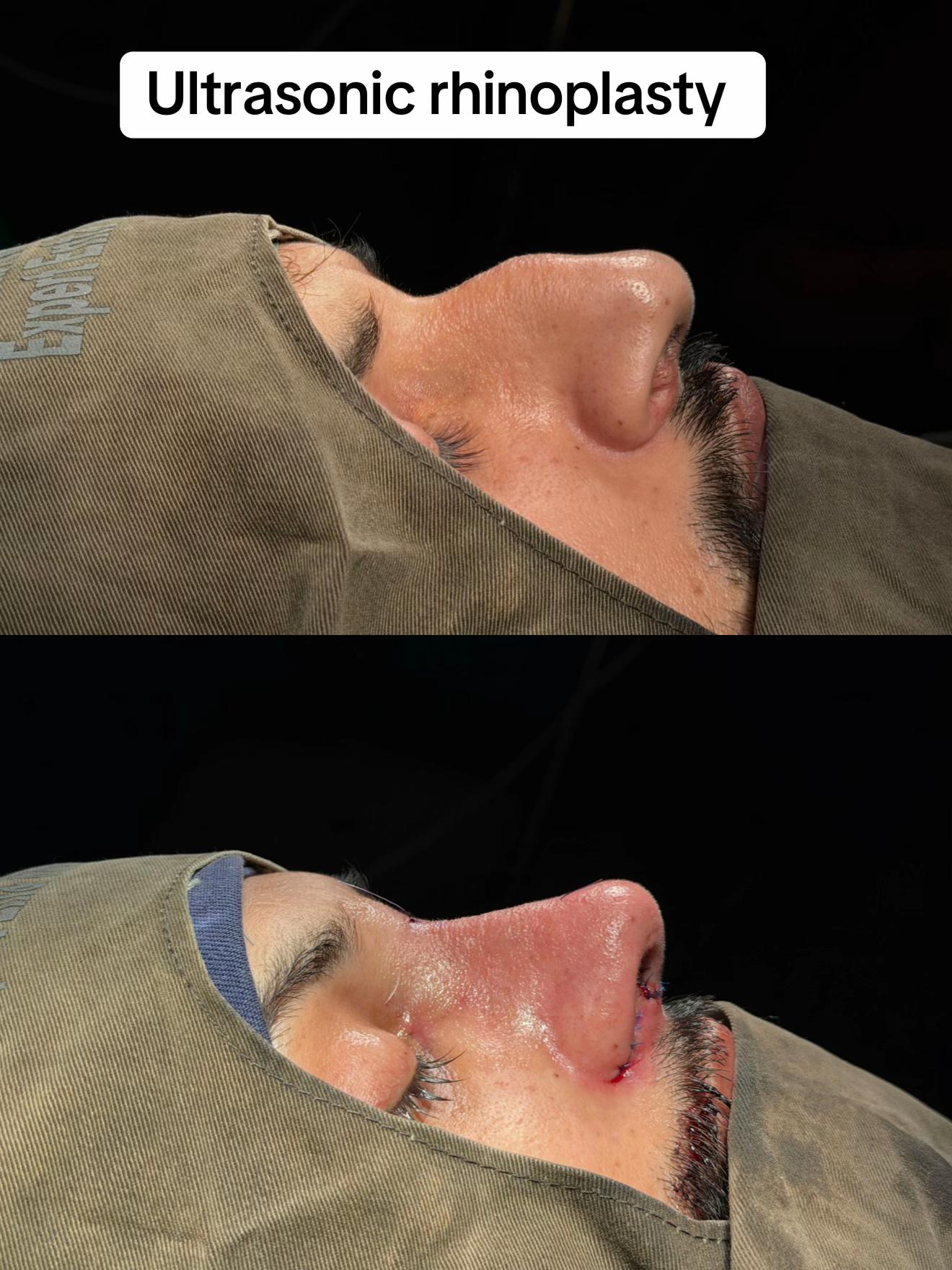 @Dr Ibrar ENT & Rhinoplasty