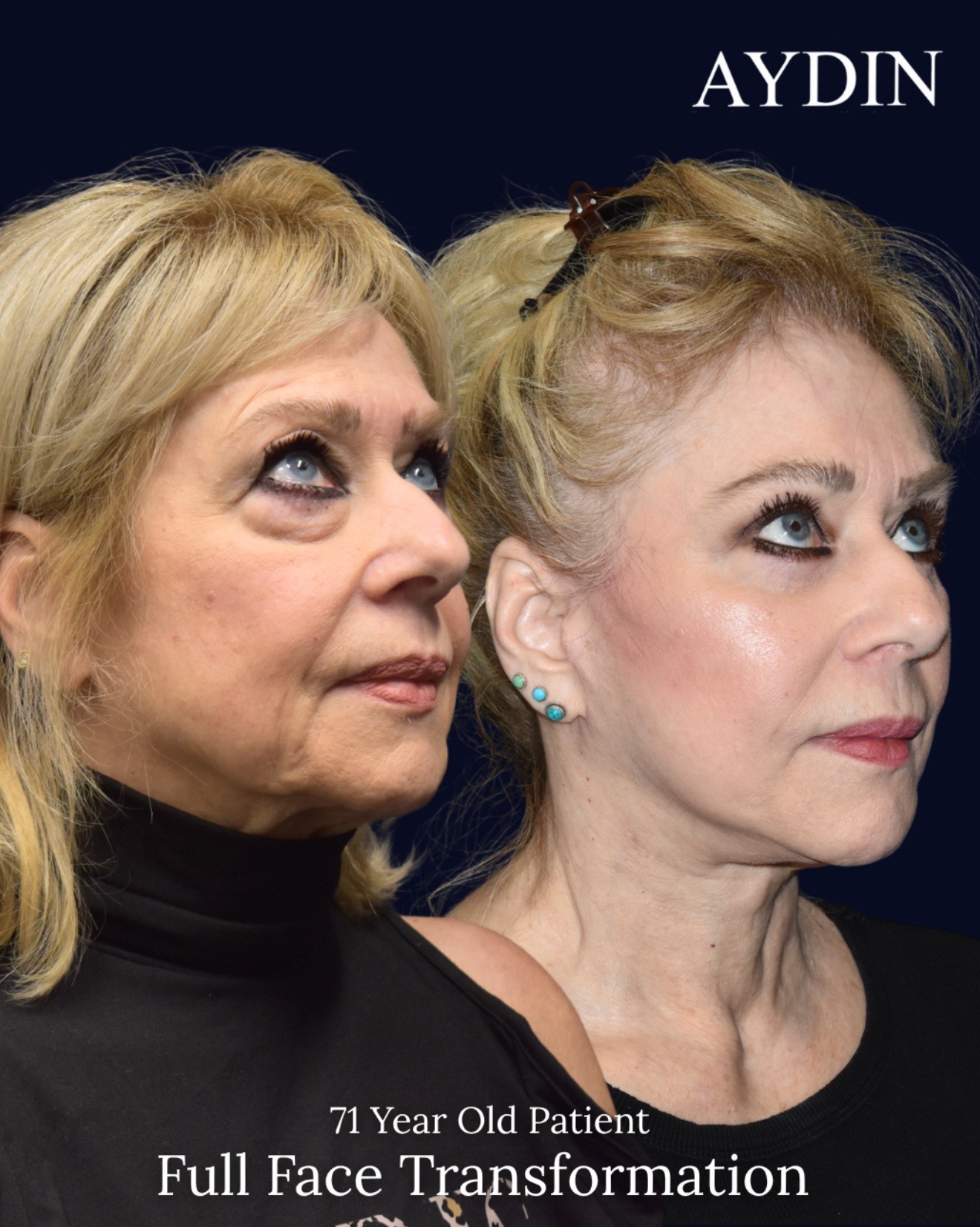 @Aydin Plastic Surgery