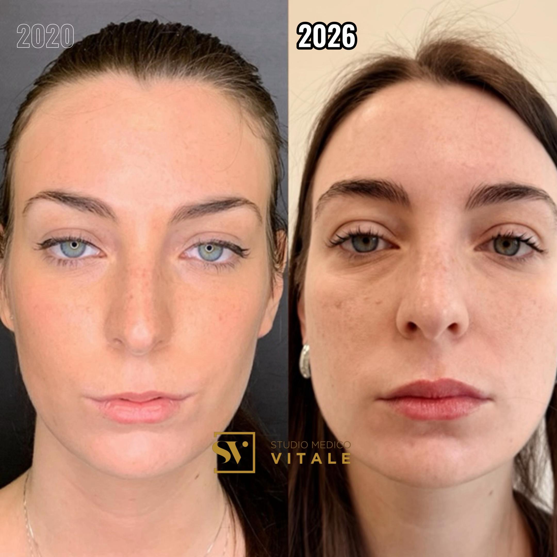 @Dr. Massimo Vitale