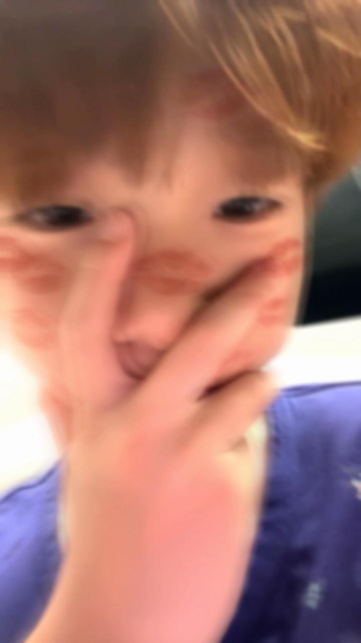 @격격