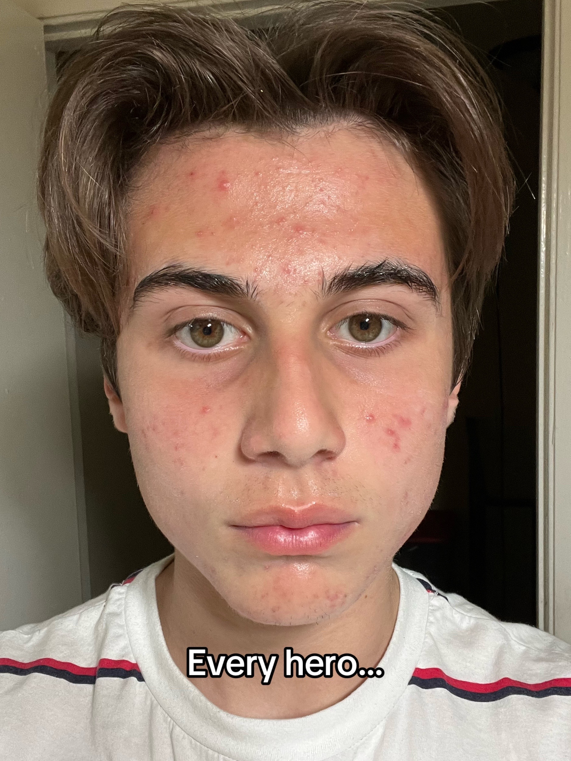 @Euro ⚜️