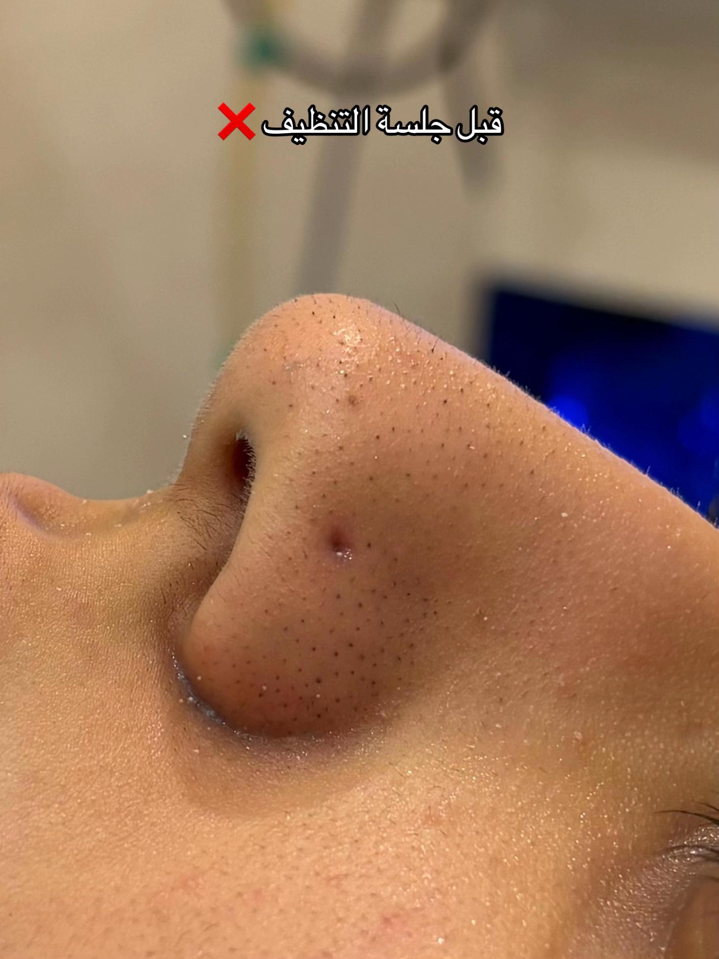 @مزدانه (فرع الملك عبدالله)