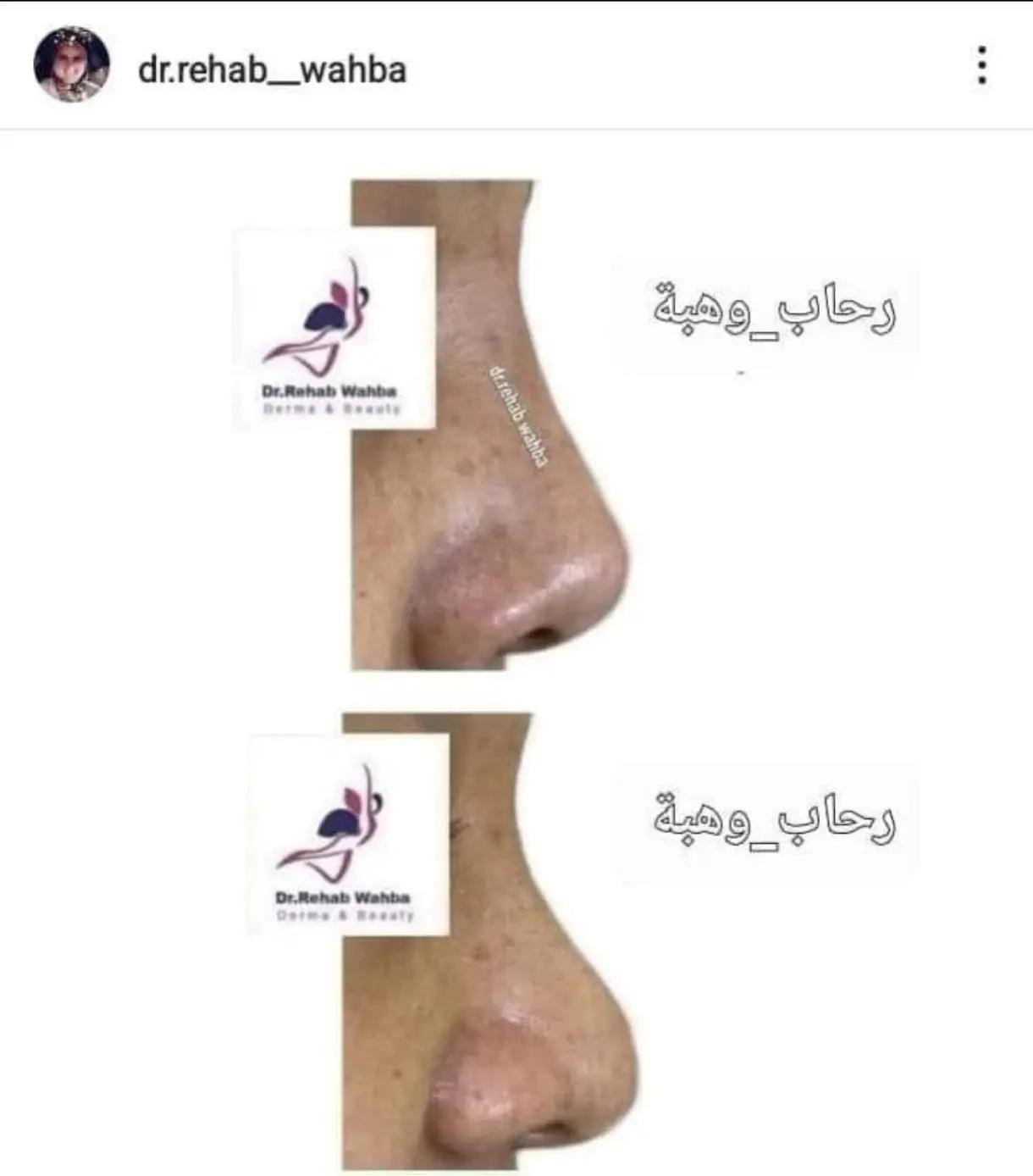 @Dr fatma & Dr Rehab Wahba