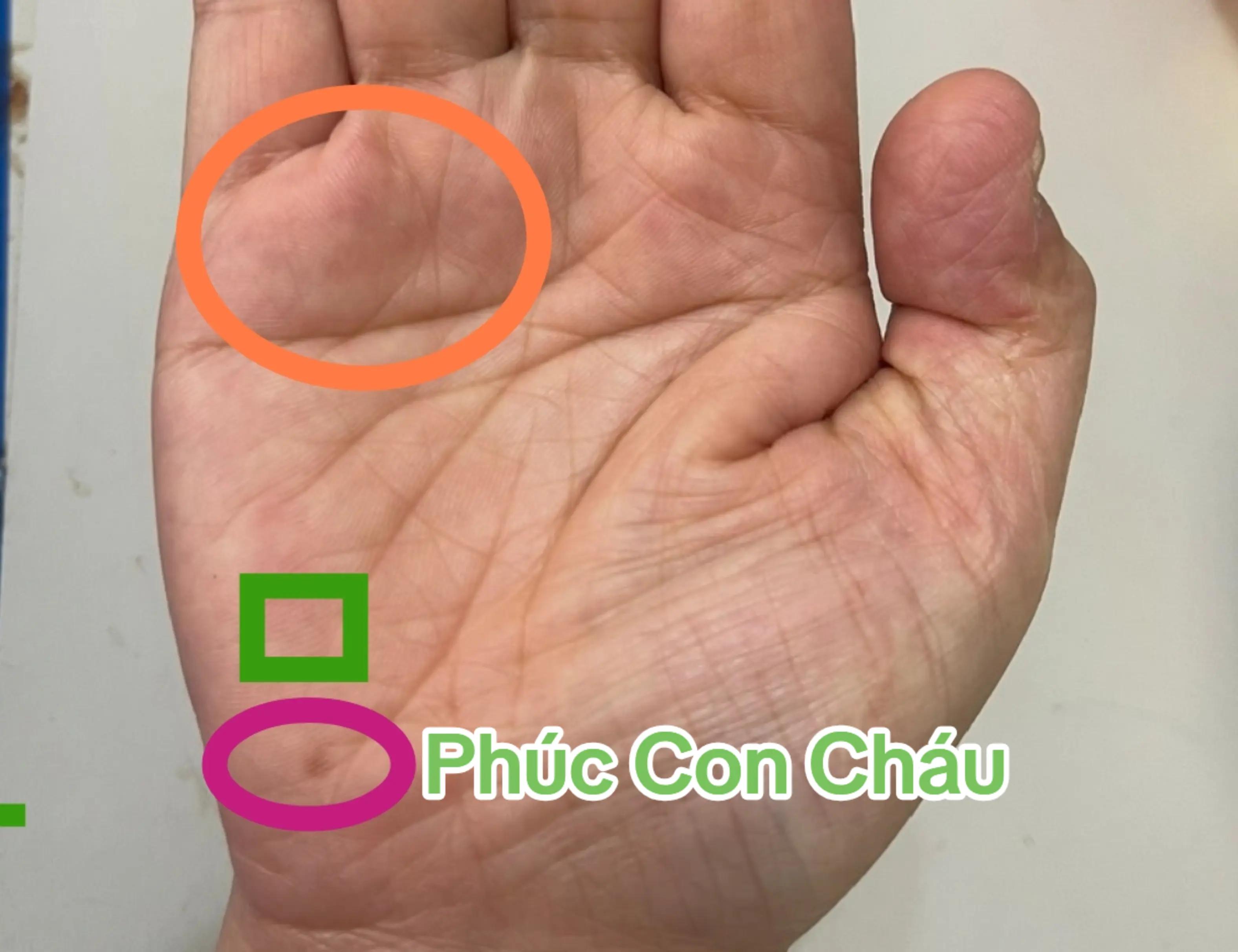 @Nh&acirc;n Tướng Sửa M&igrave;nh (Đỗ L&acirc;m)