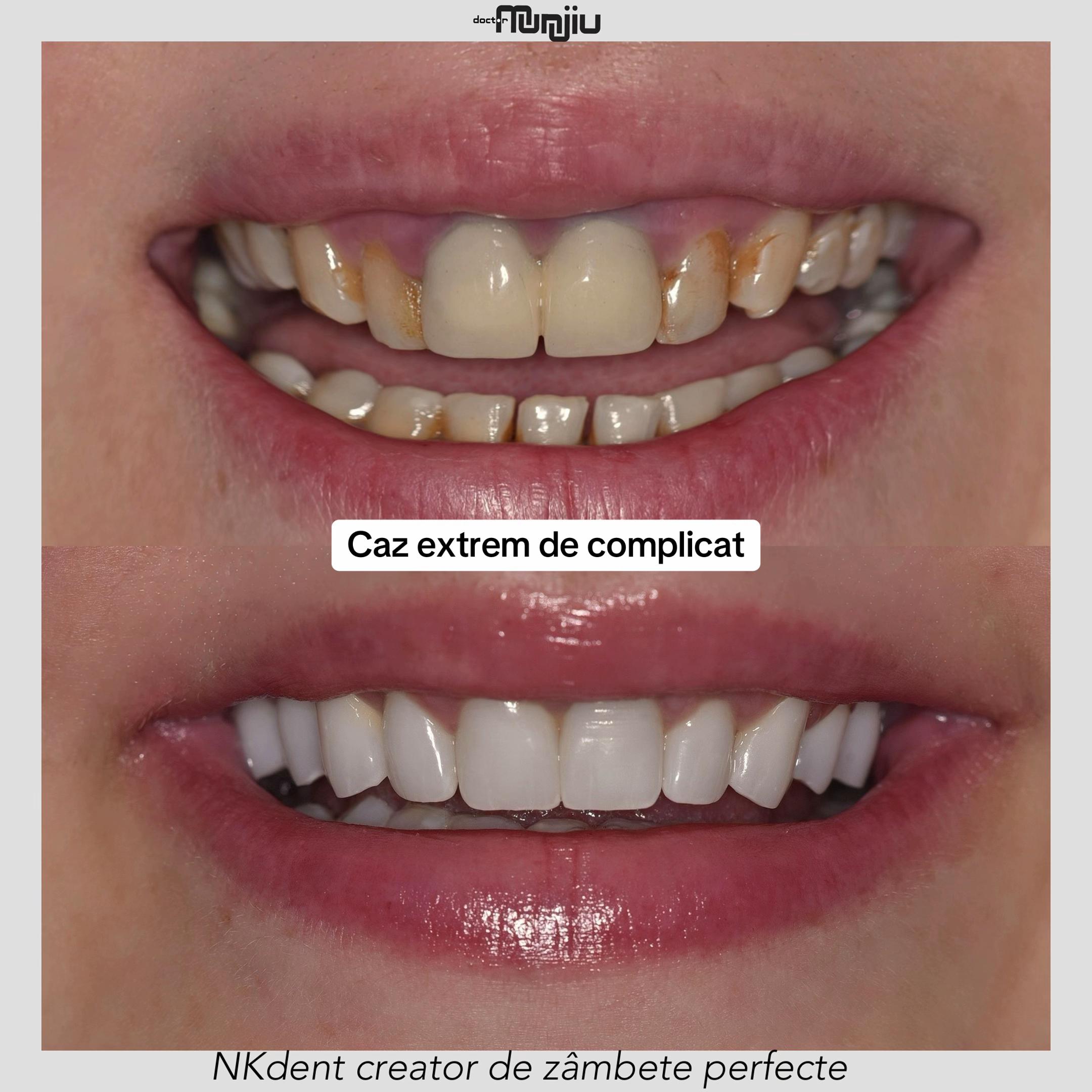 @Dr. Nina Munjiu