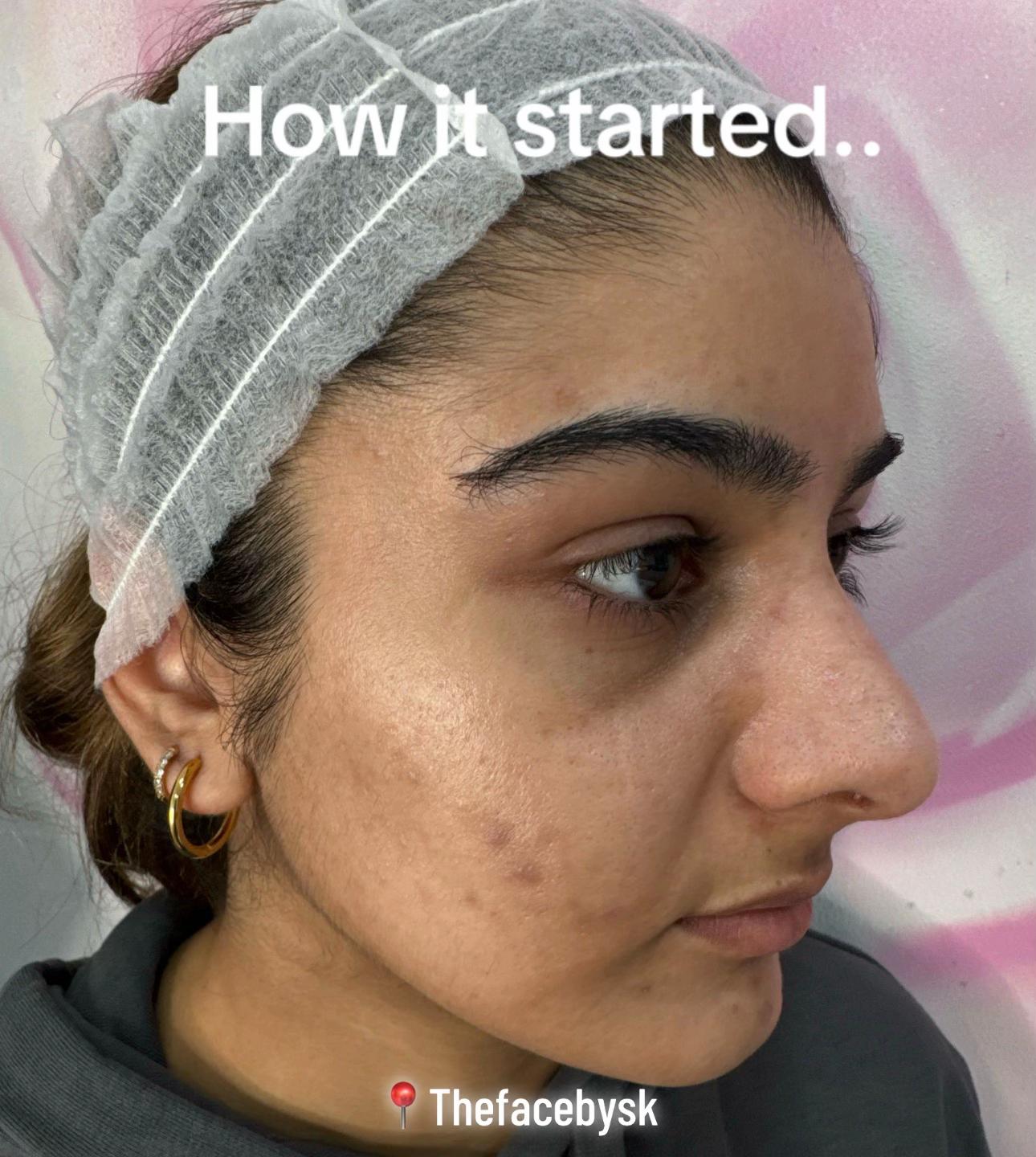 @The Facebysk