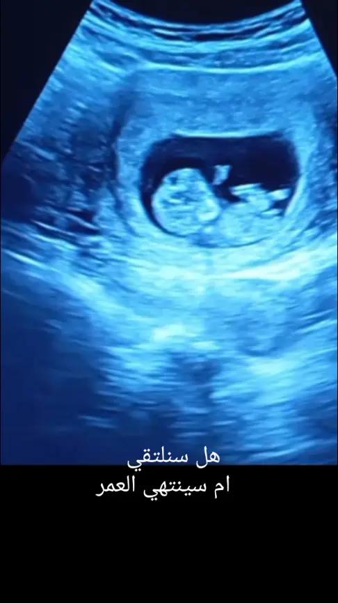 @بنت الحال