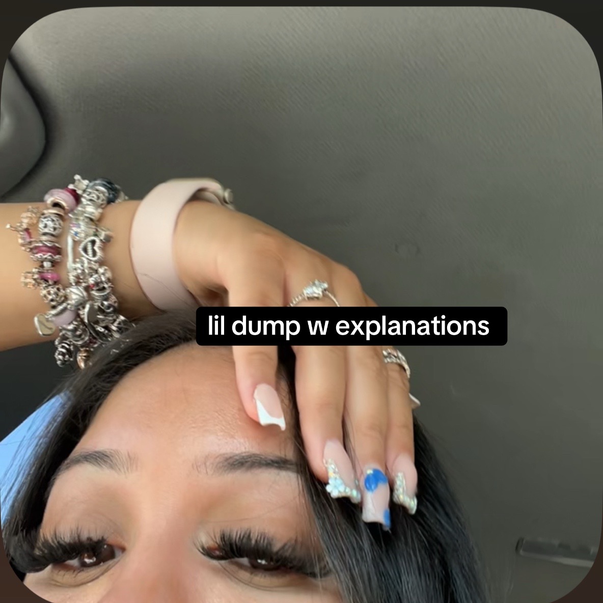 @AP