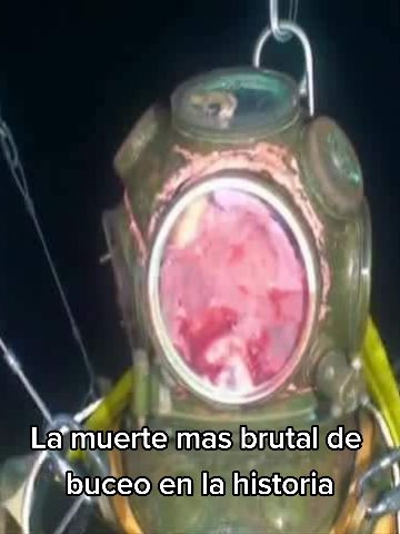 @La Mano Con Pelos