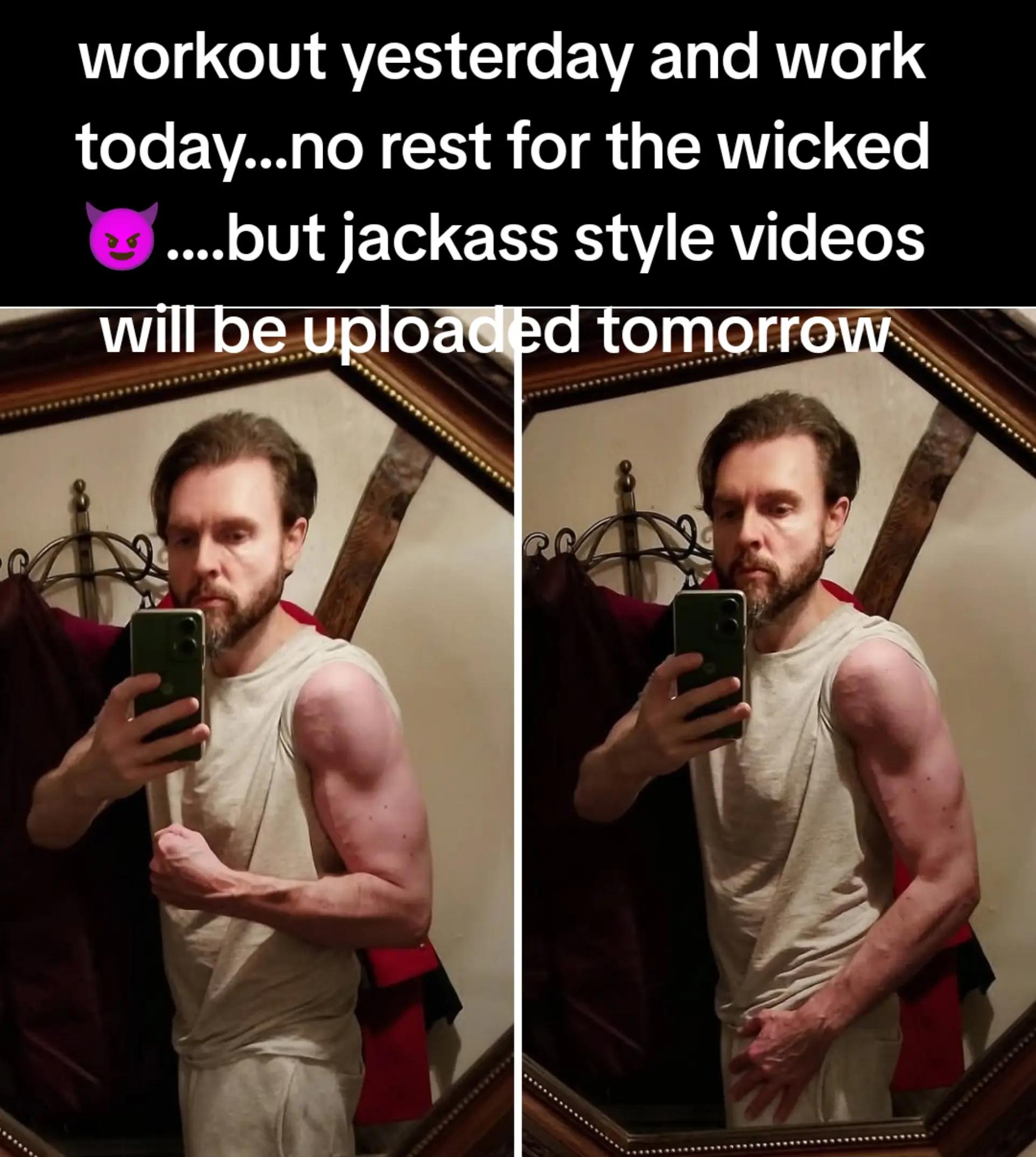 @MTV-JACKASS-FAN