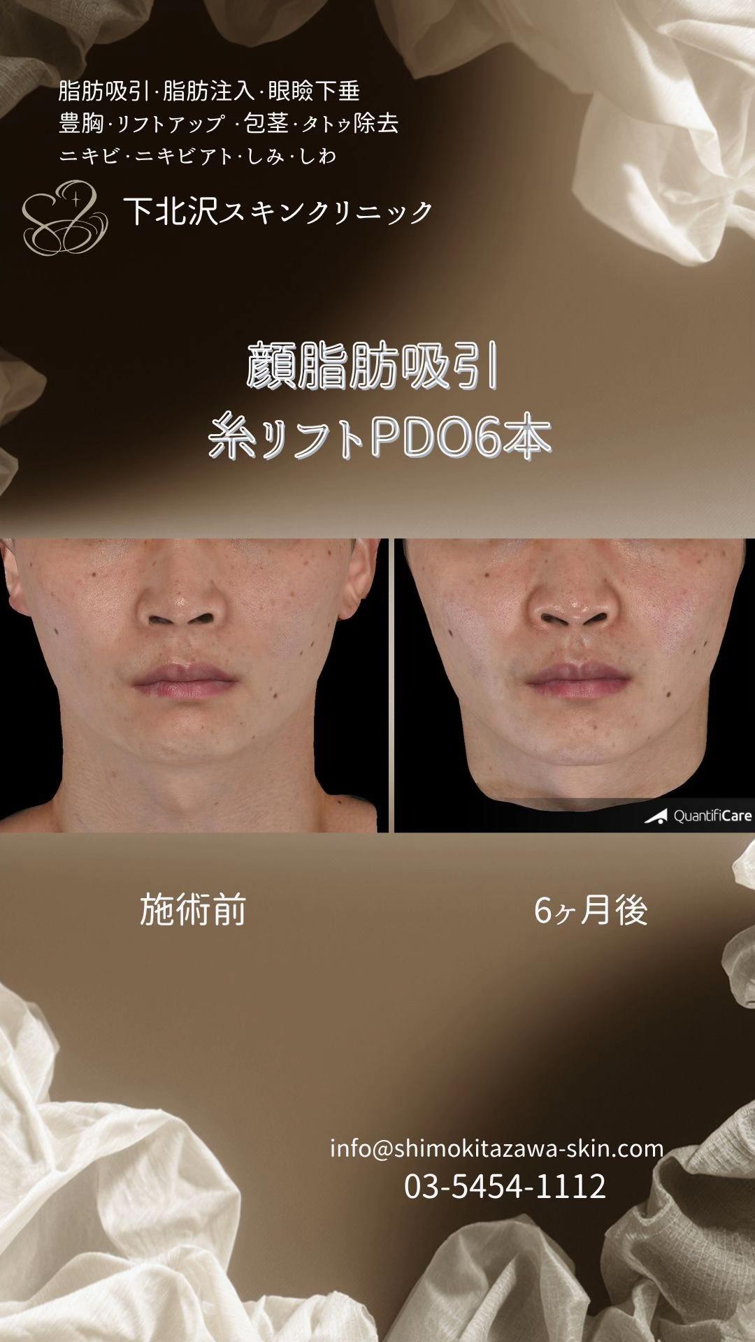 @下北沢スキンクリニック院長・こころの美容外科医・保坂宗孝