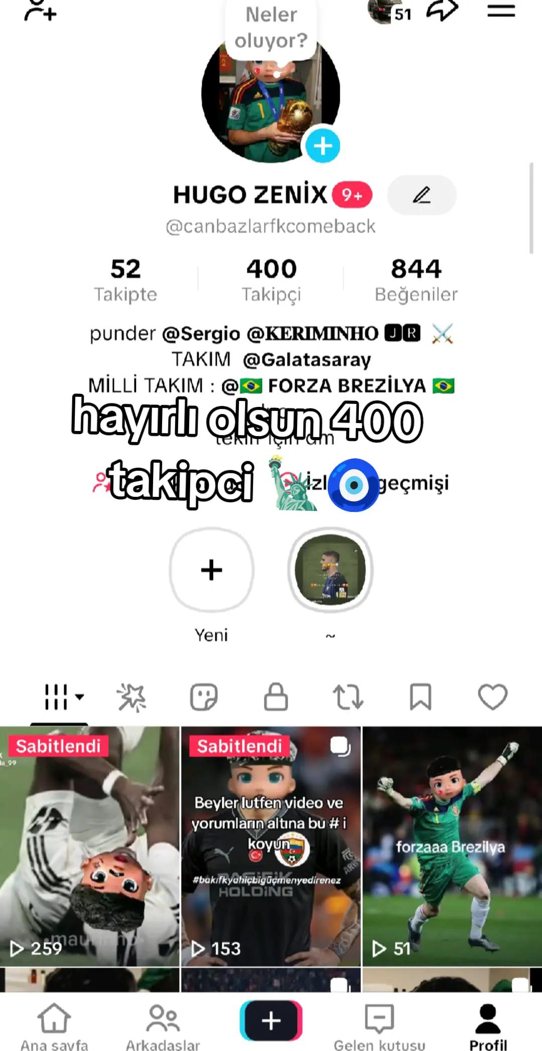 @HUGO ZENİX