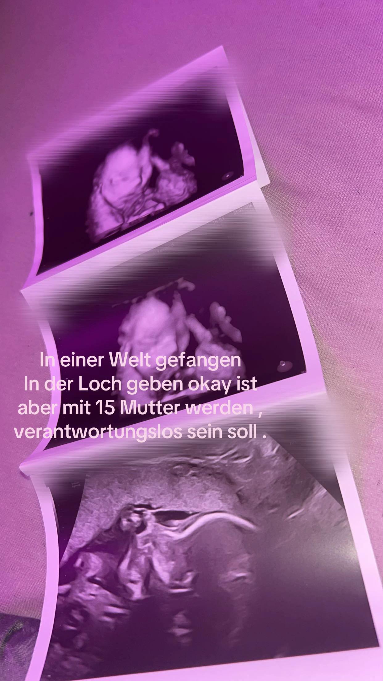 @𝒫𝒾𝒶