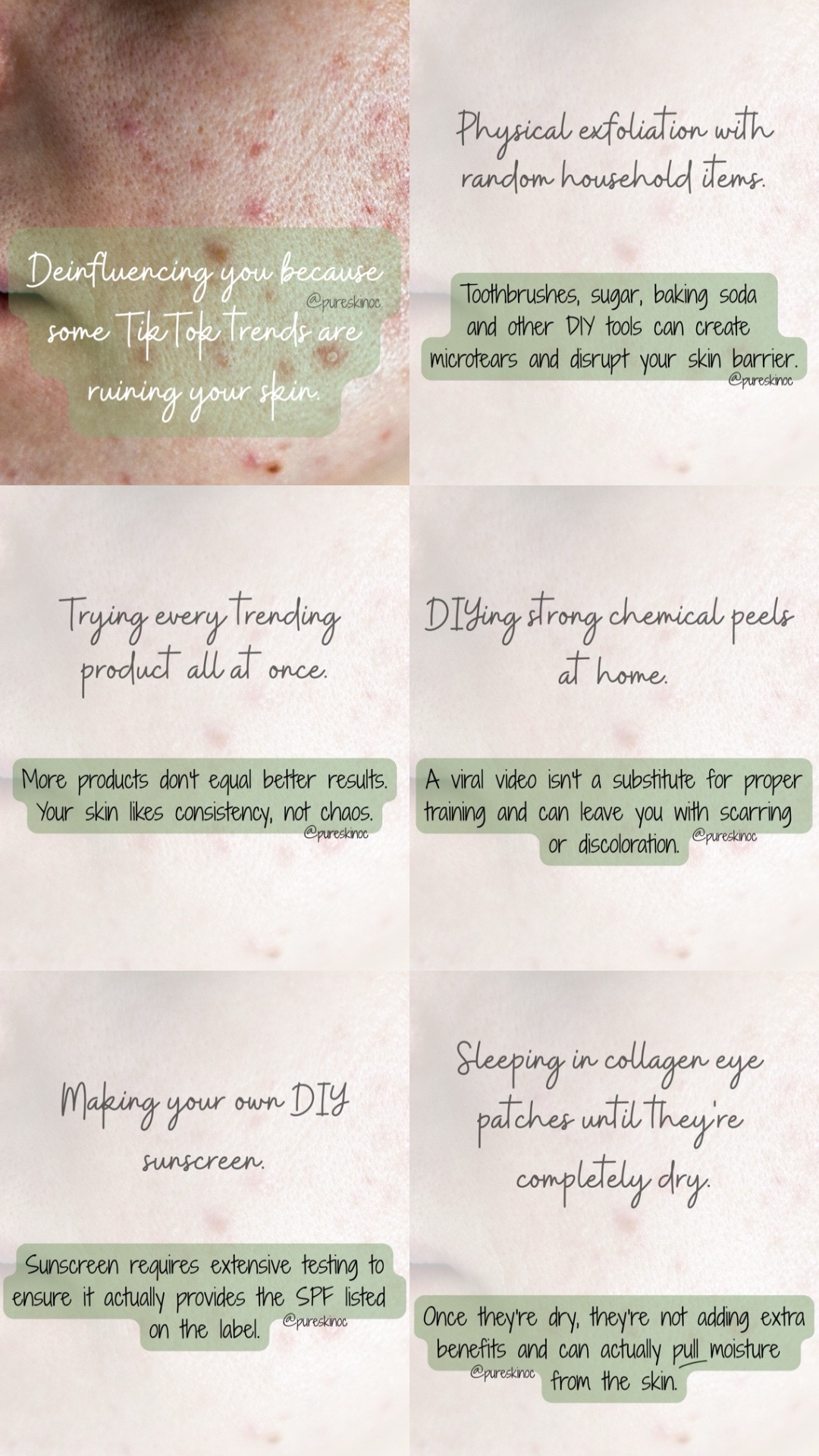 @Pure Skin OC