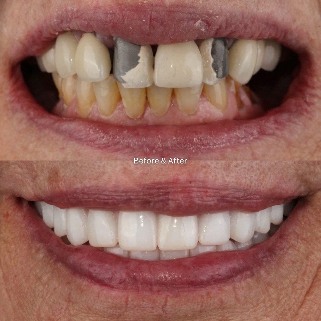 @Dallas Smile Specialists 🦷