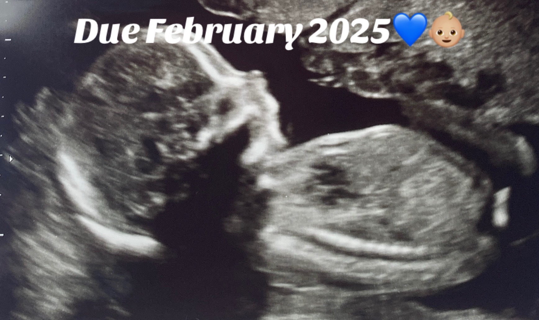 @Ellz🦋🦋