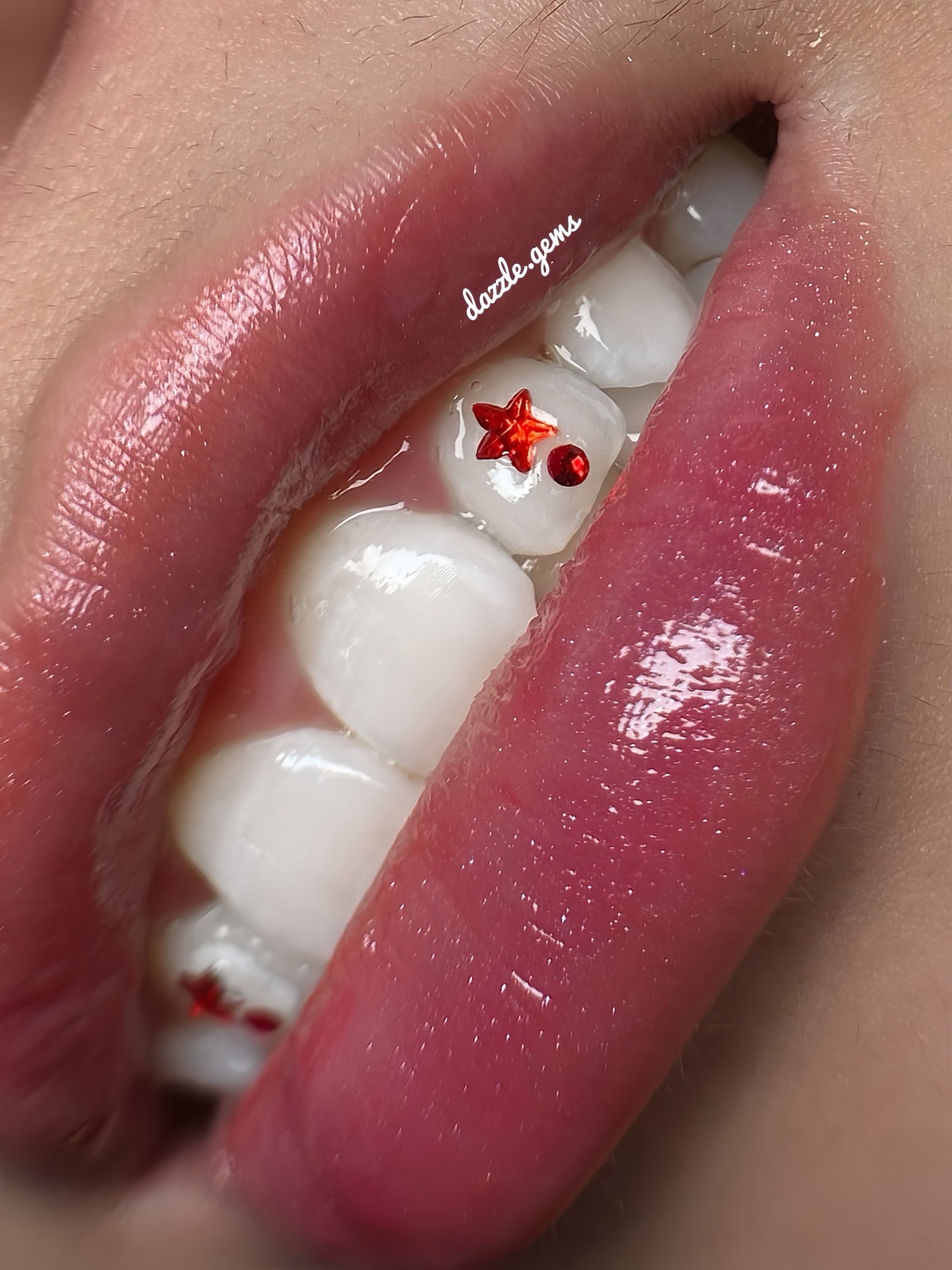 @Piercing - Toothgems