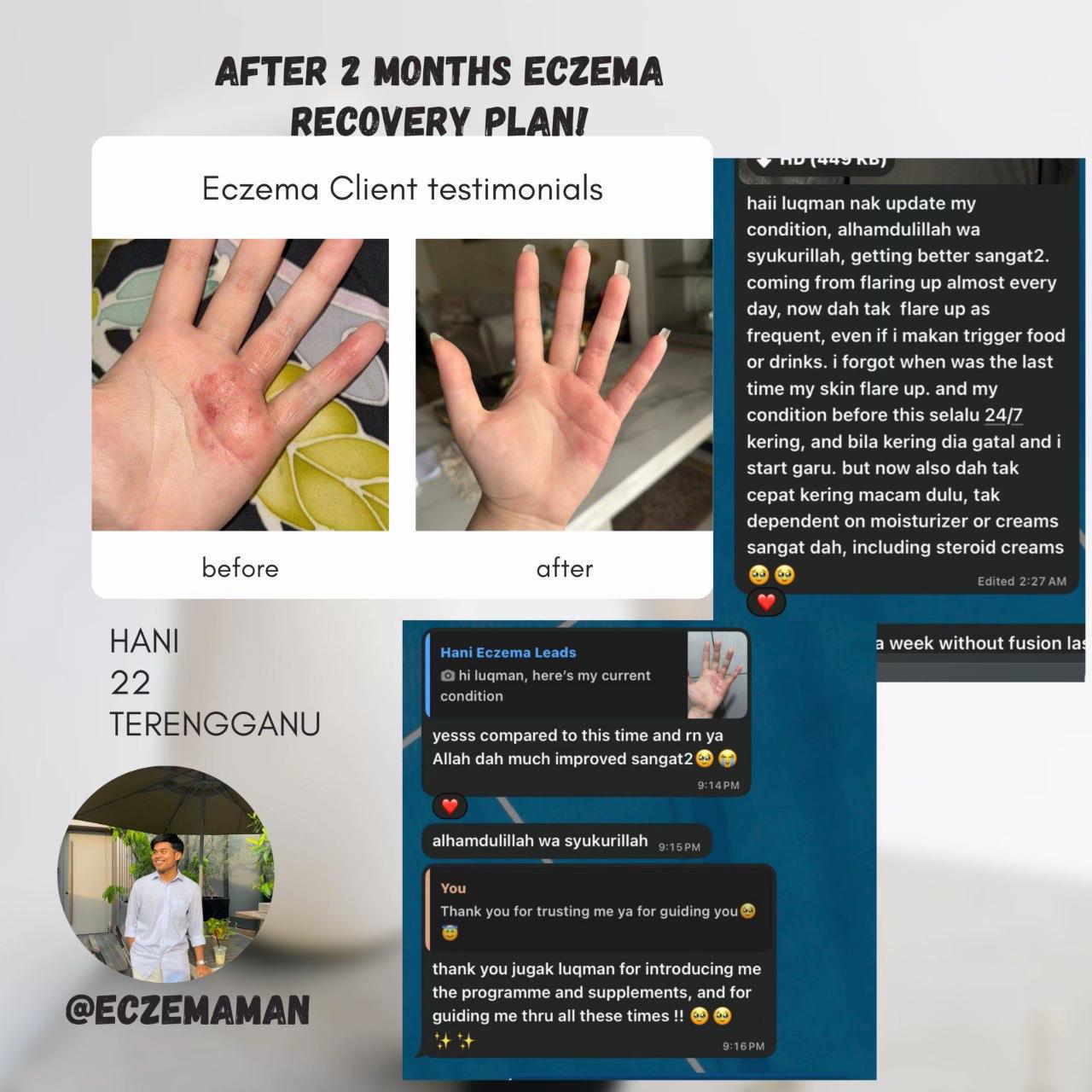 @EczemaMan