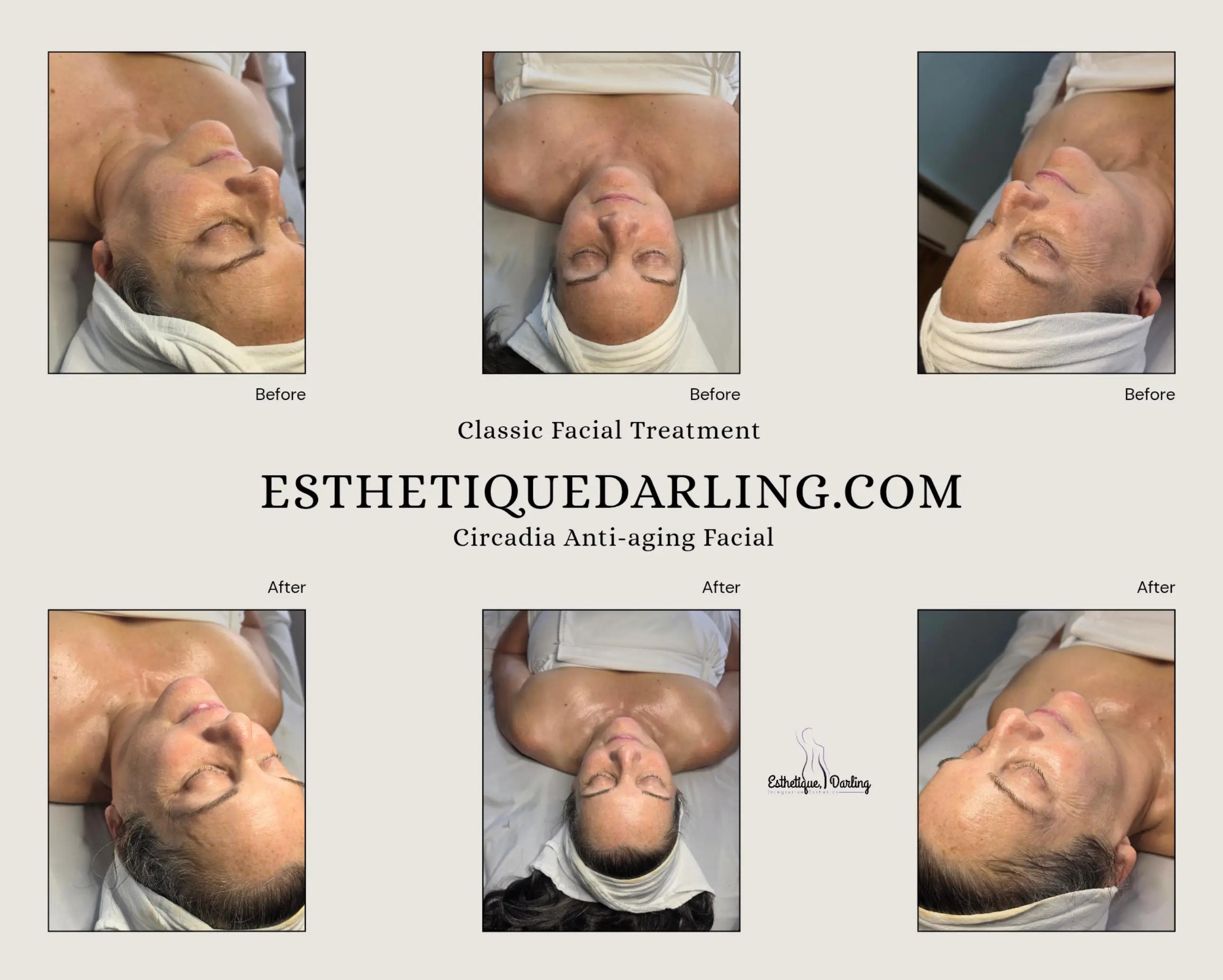 @Esthetique, Darling LLC