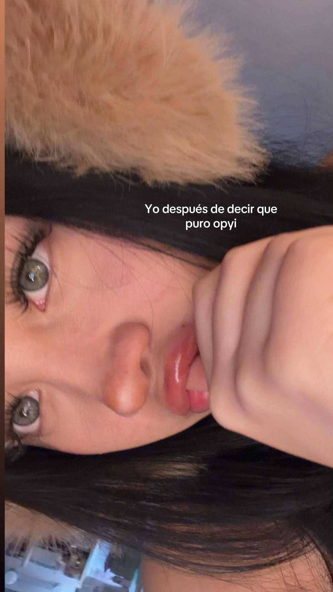 @Alisson Bautista ๐ฆ