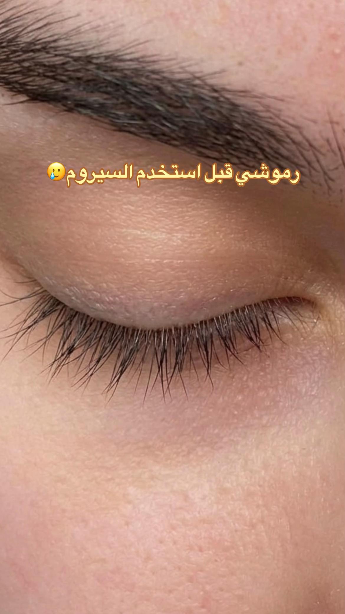 @RevitaLash | ريفيتالاش