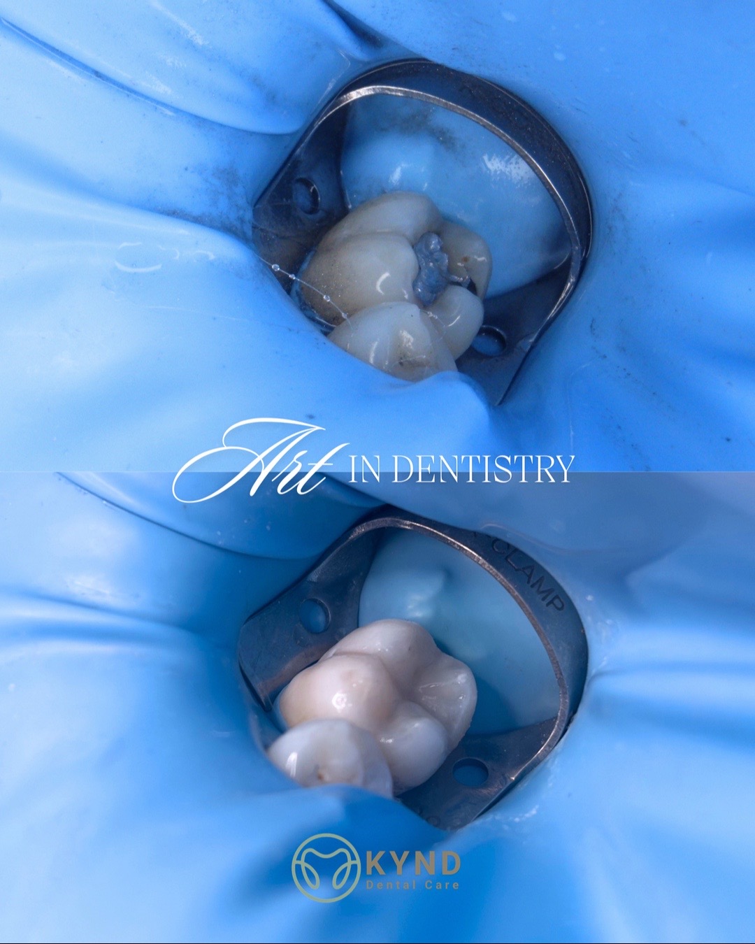 @KYND Dental Care |Dentist BALI